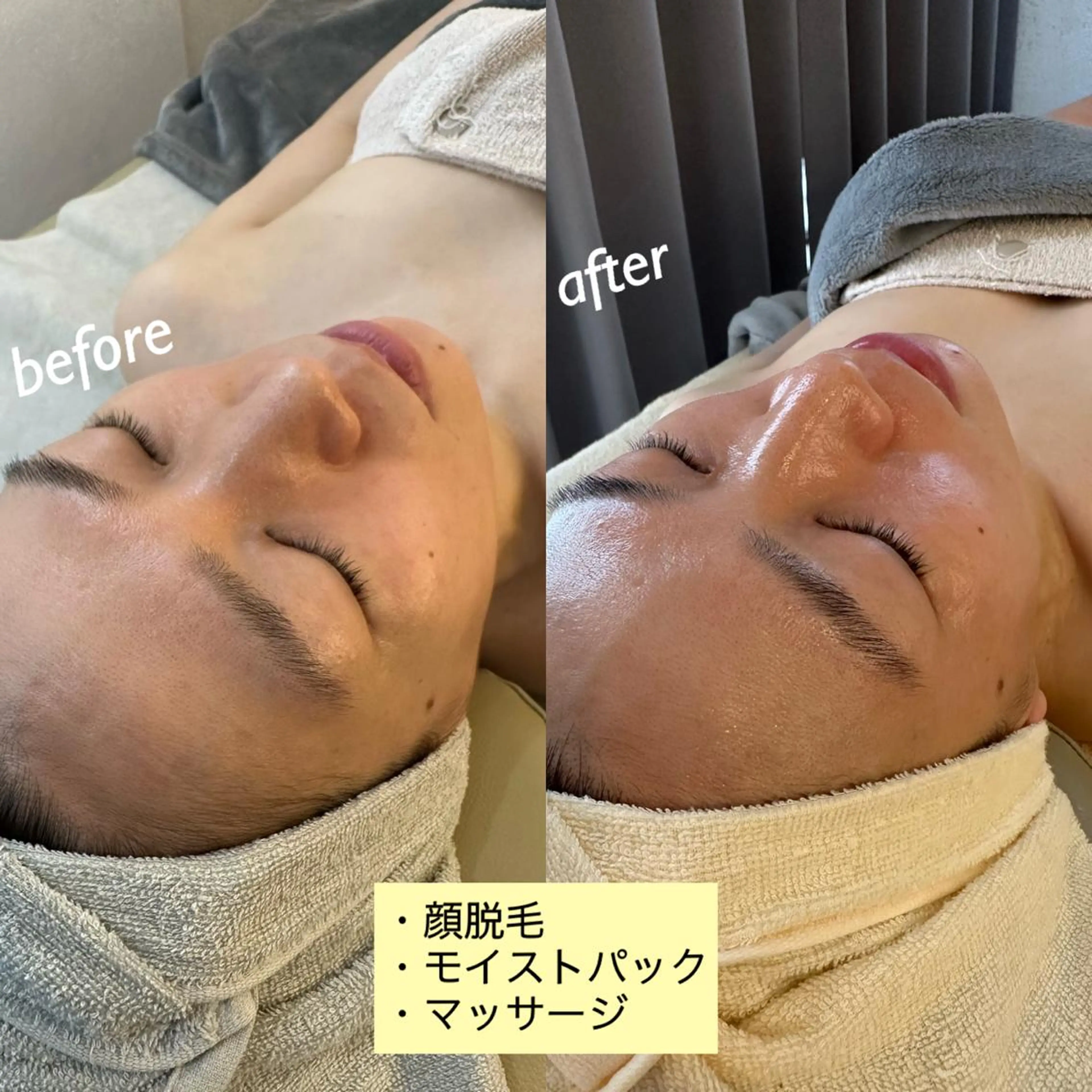 エステ うなじ脱毛/美肌脱毛 LABELのエステ・リラクイメージ