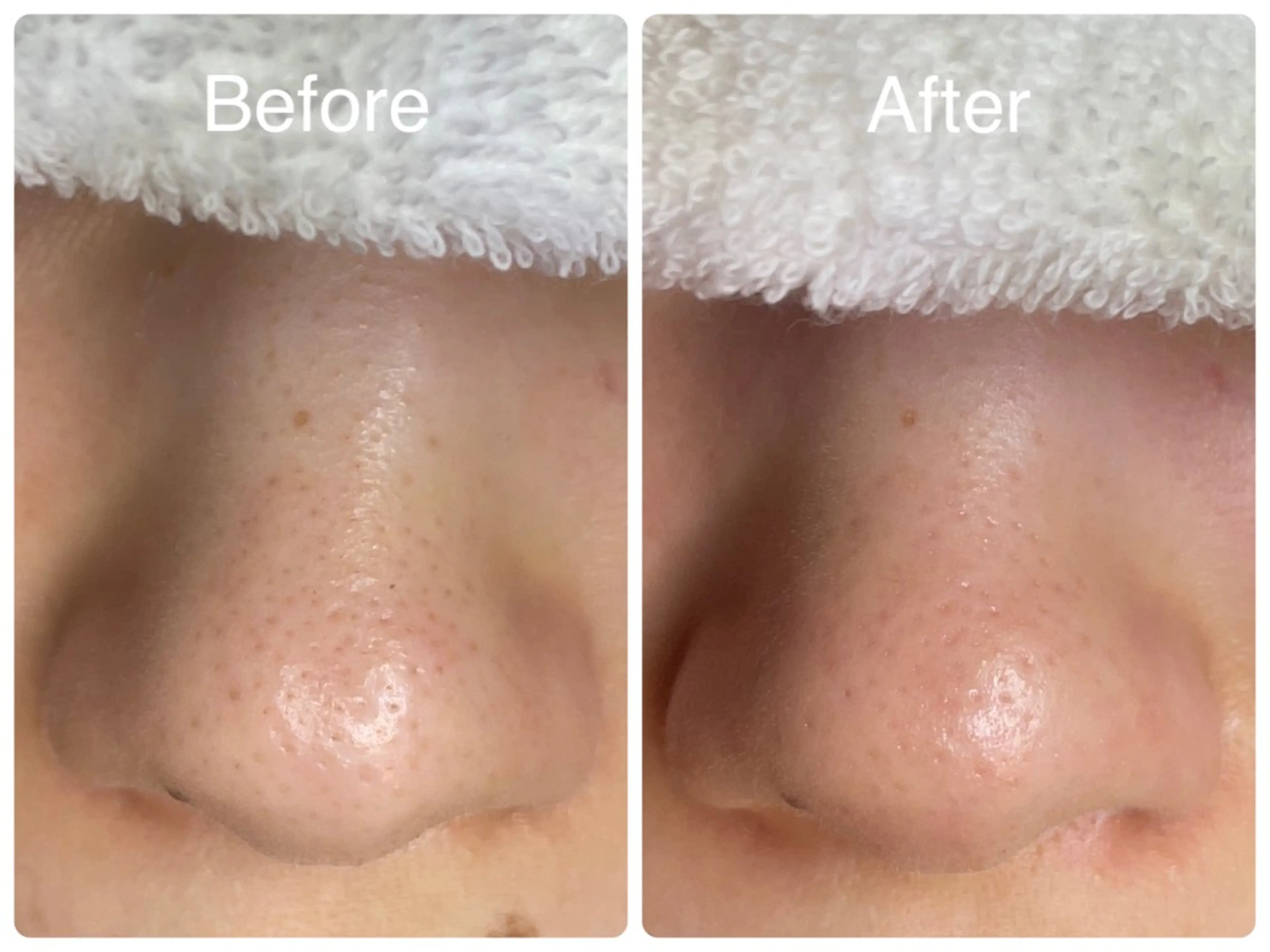 salon HATOのエステ・リラクイメージ