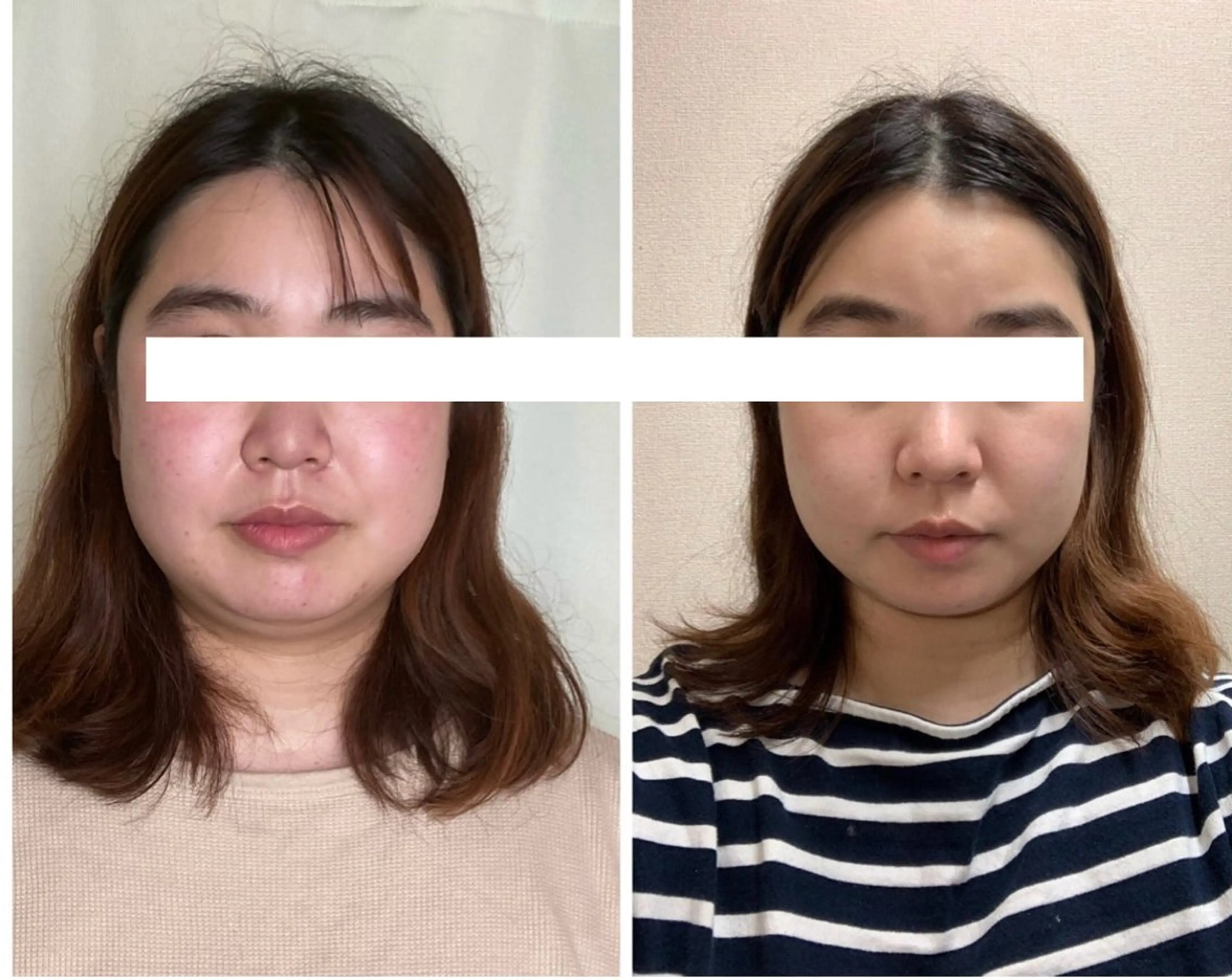 丸顔さんの救世主 高田 くみのエステ・リラクイメージ