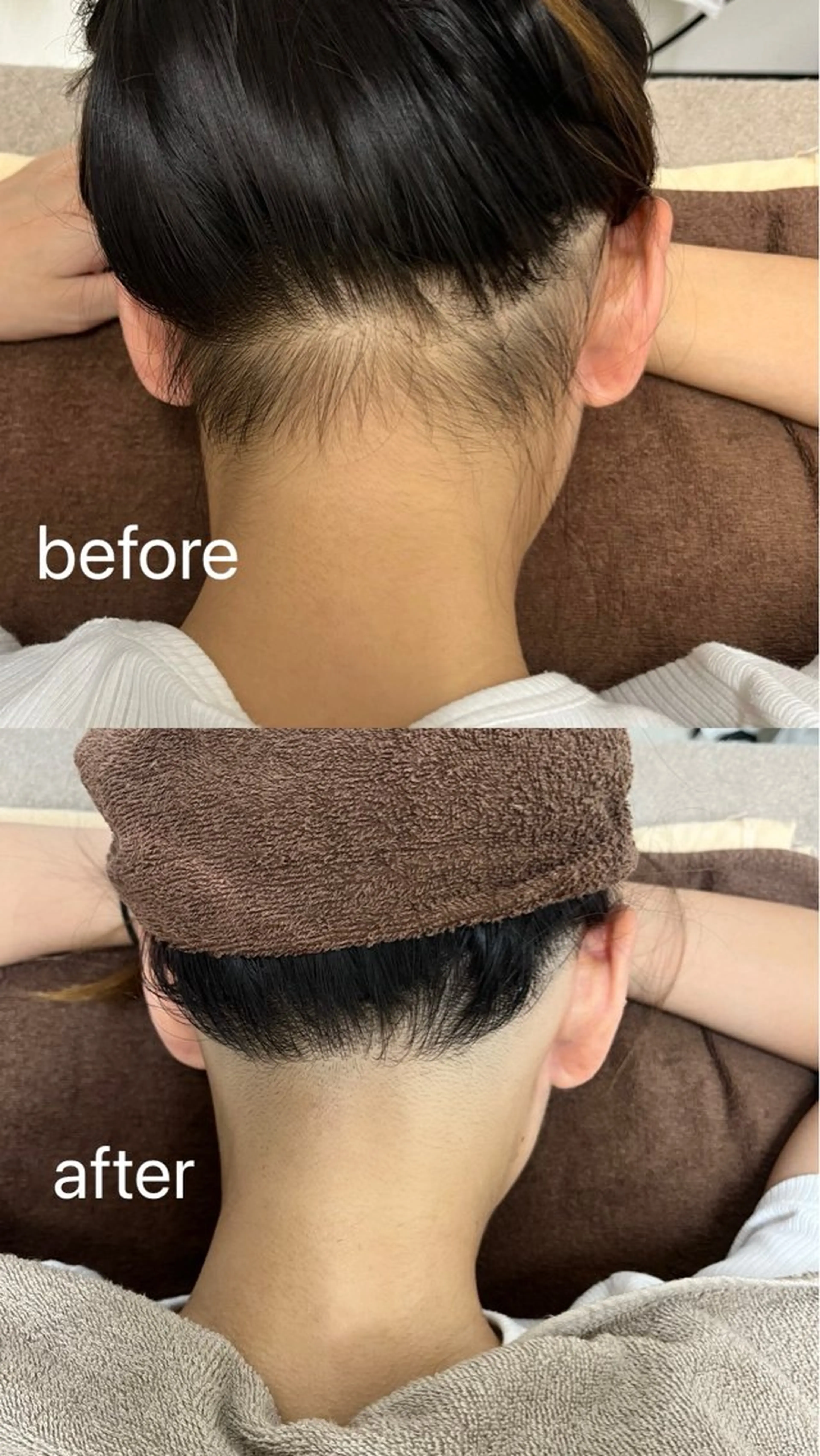 Mパーツ(いずれか1つ) うなじ・V・I・Oの写真