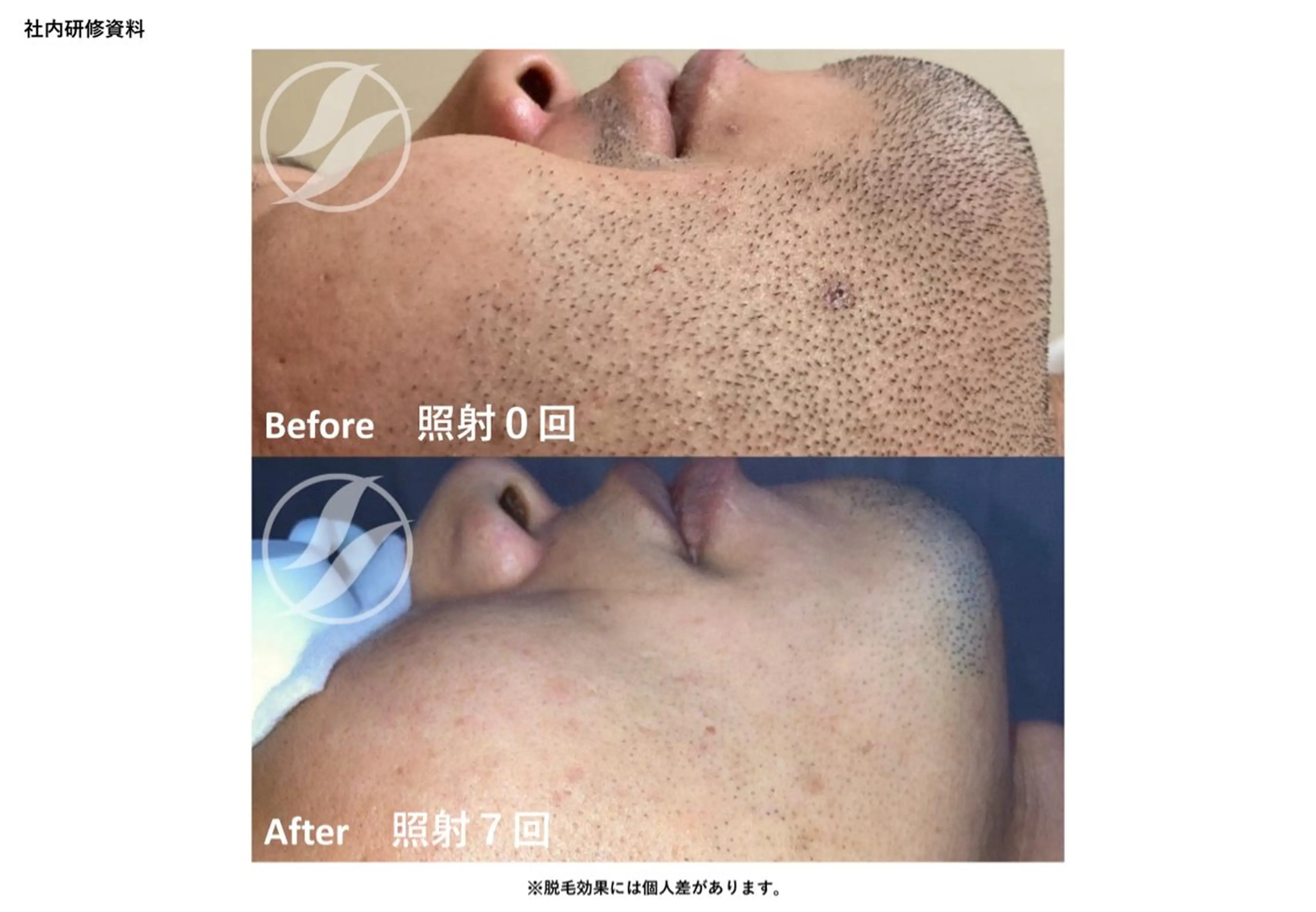 メンズ Kanaloa beauty salon所属・腸もみ・メンズ脱毛・ 毛穴洗浄〜カナロア〜のエステ・リラクイメージ