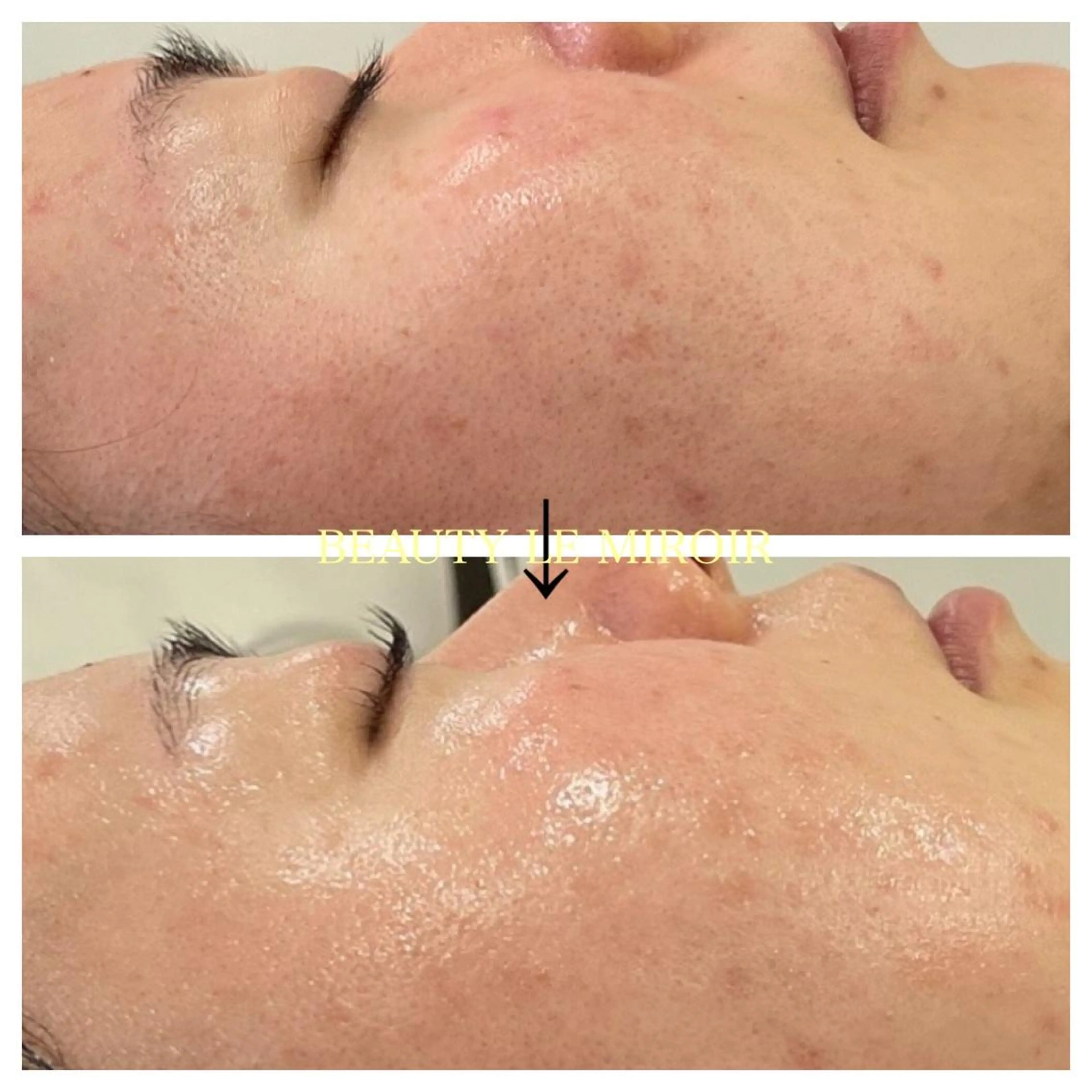 マツエク・マツパ ビューティー ミロワールのエステ・リラクイメージ