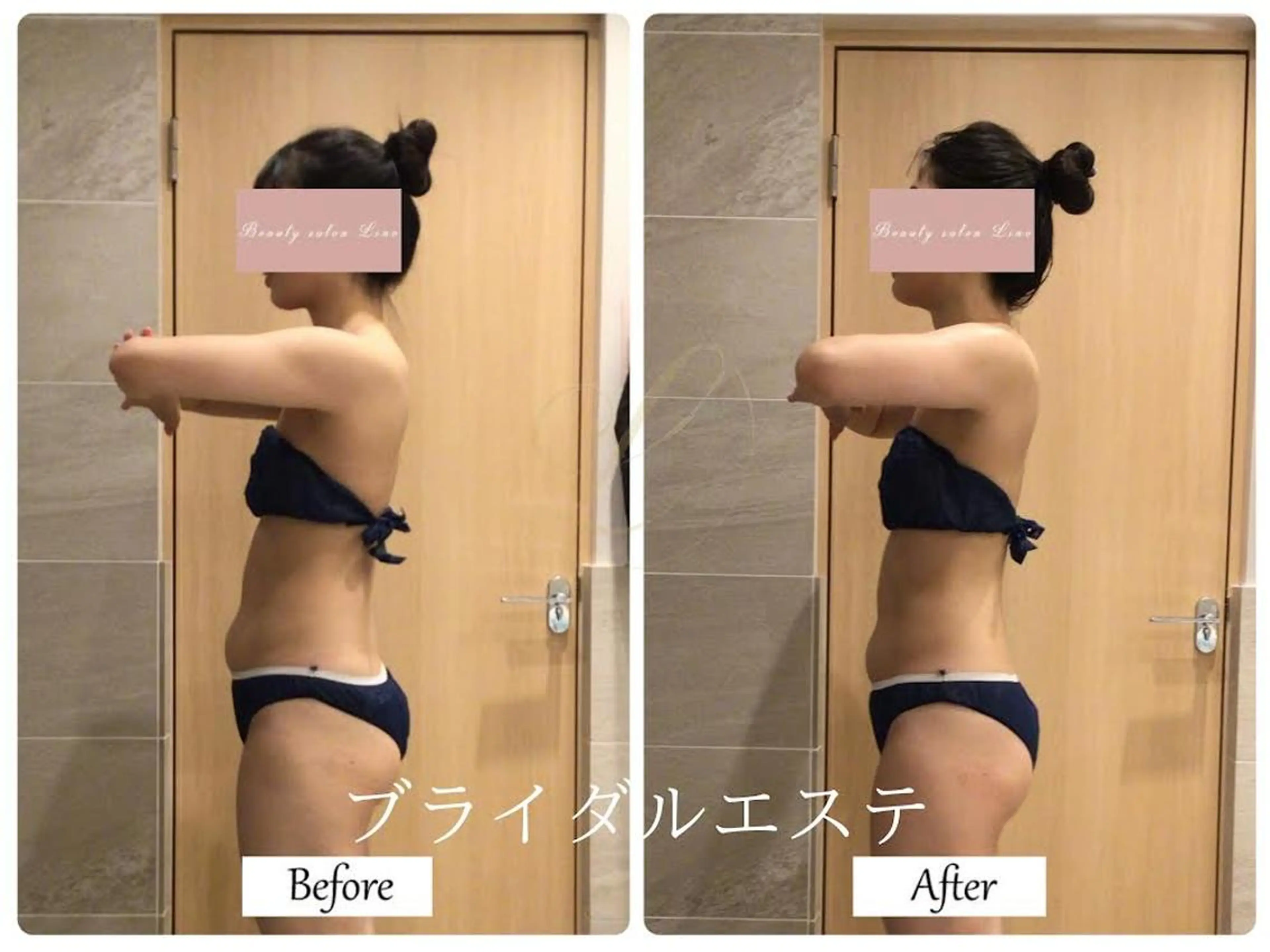 エステ リラク ブライダルサロン ｜Lino【堀江】のエステ・リラクイメージ