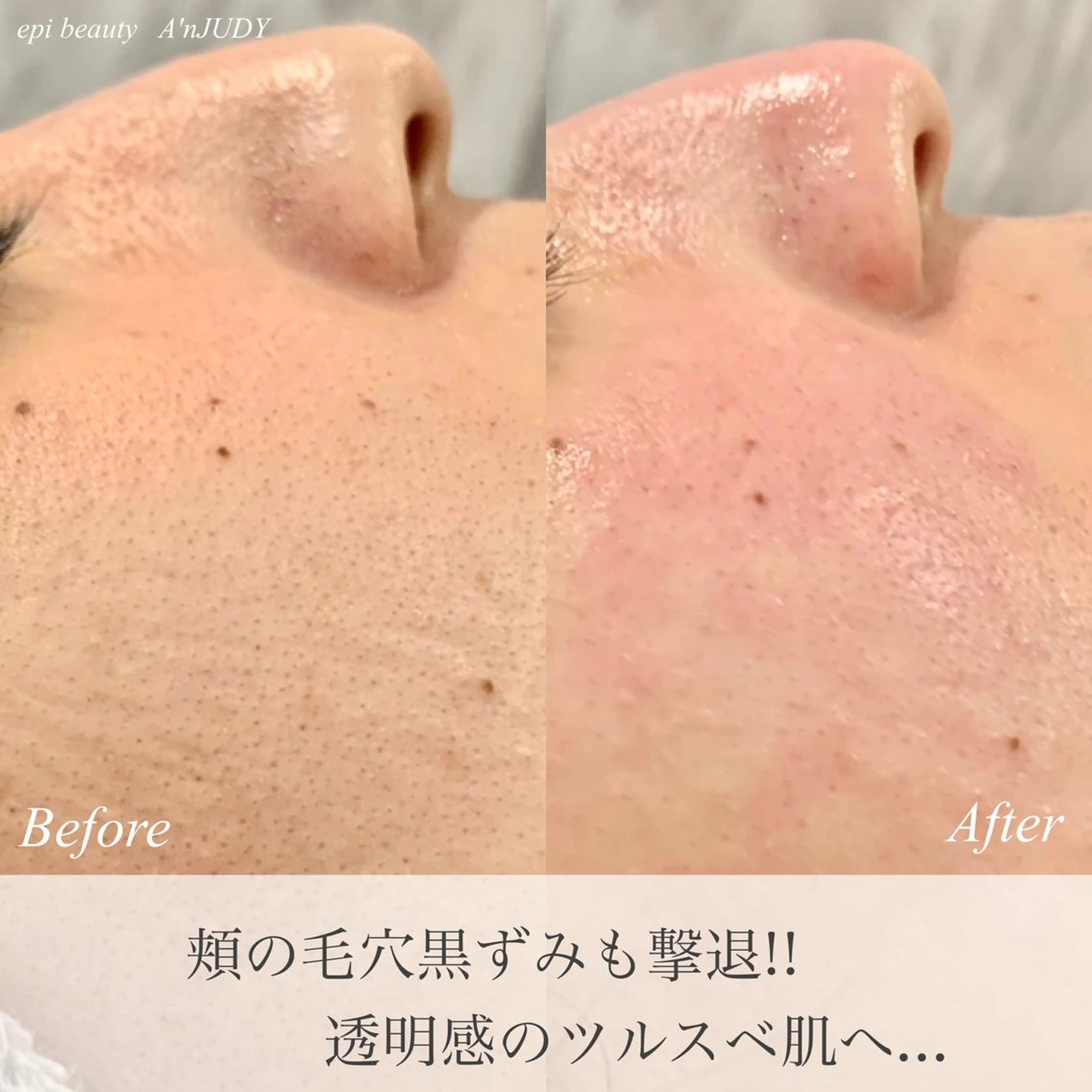 脱毛&ビューティー A'nJUDYの眉毛・アイブロウイメージ