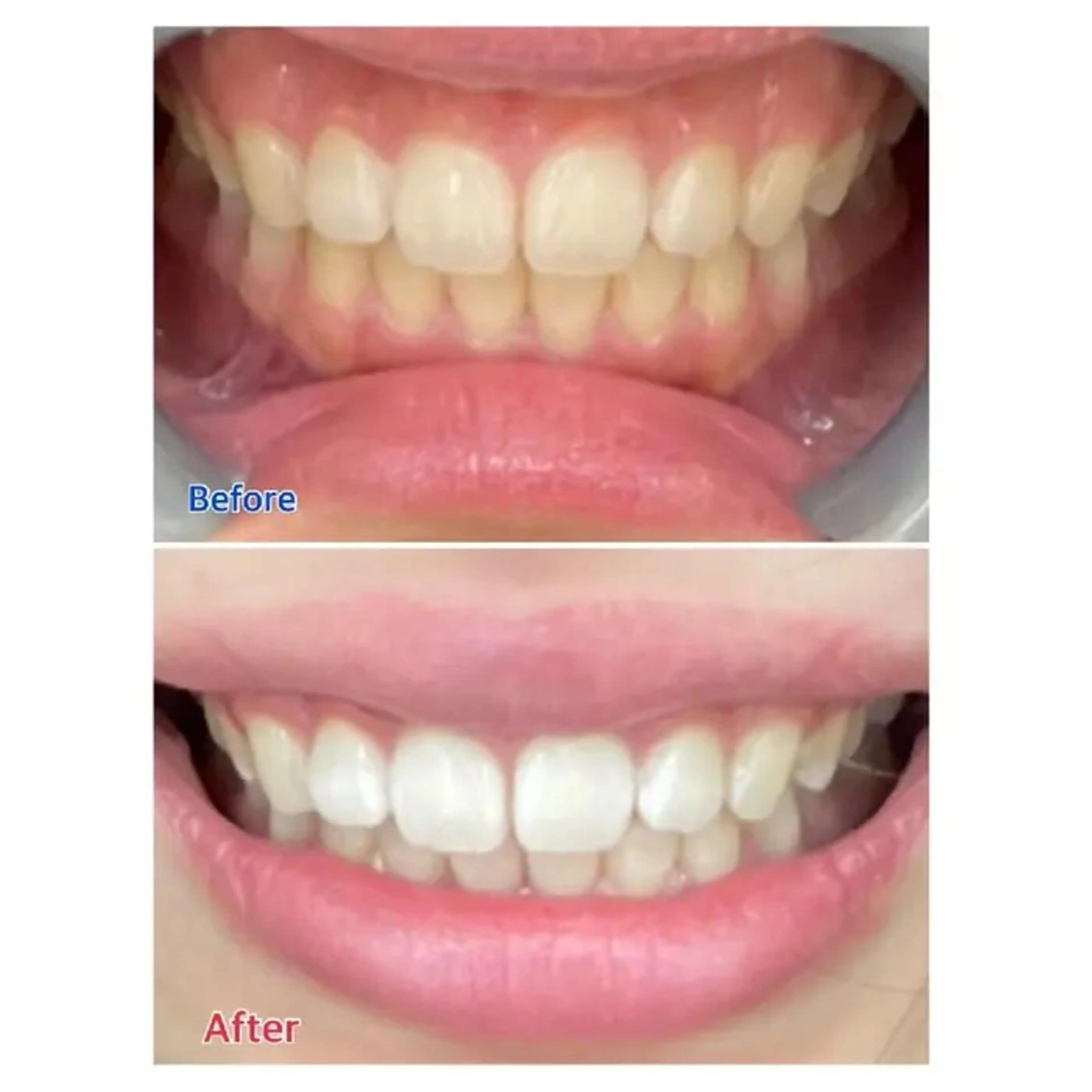 M渋谷 ホワイトニングのエステ・リラクイメージ