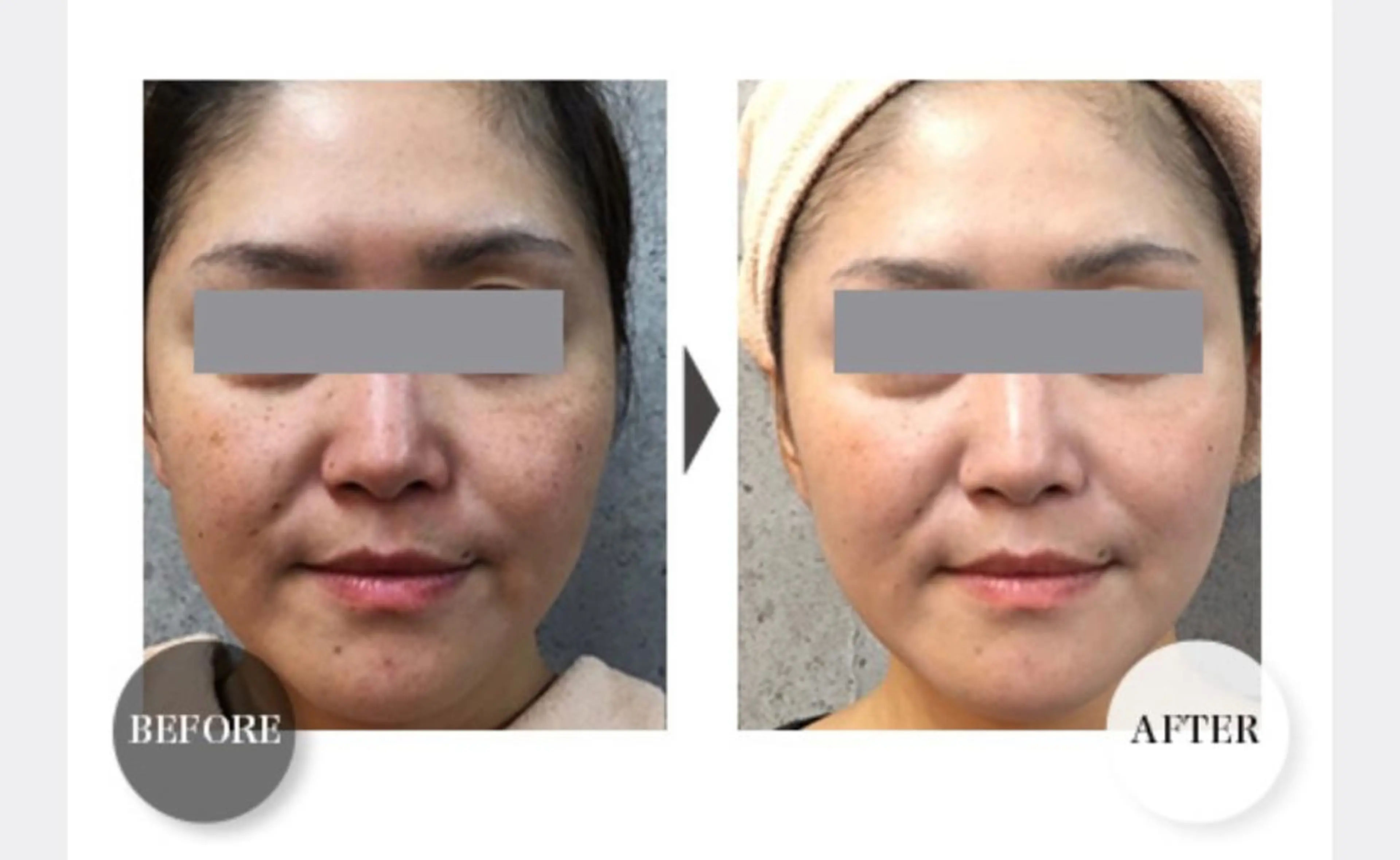 HappIness 遠赤外線ドームのエステ・リラクイメージ