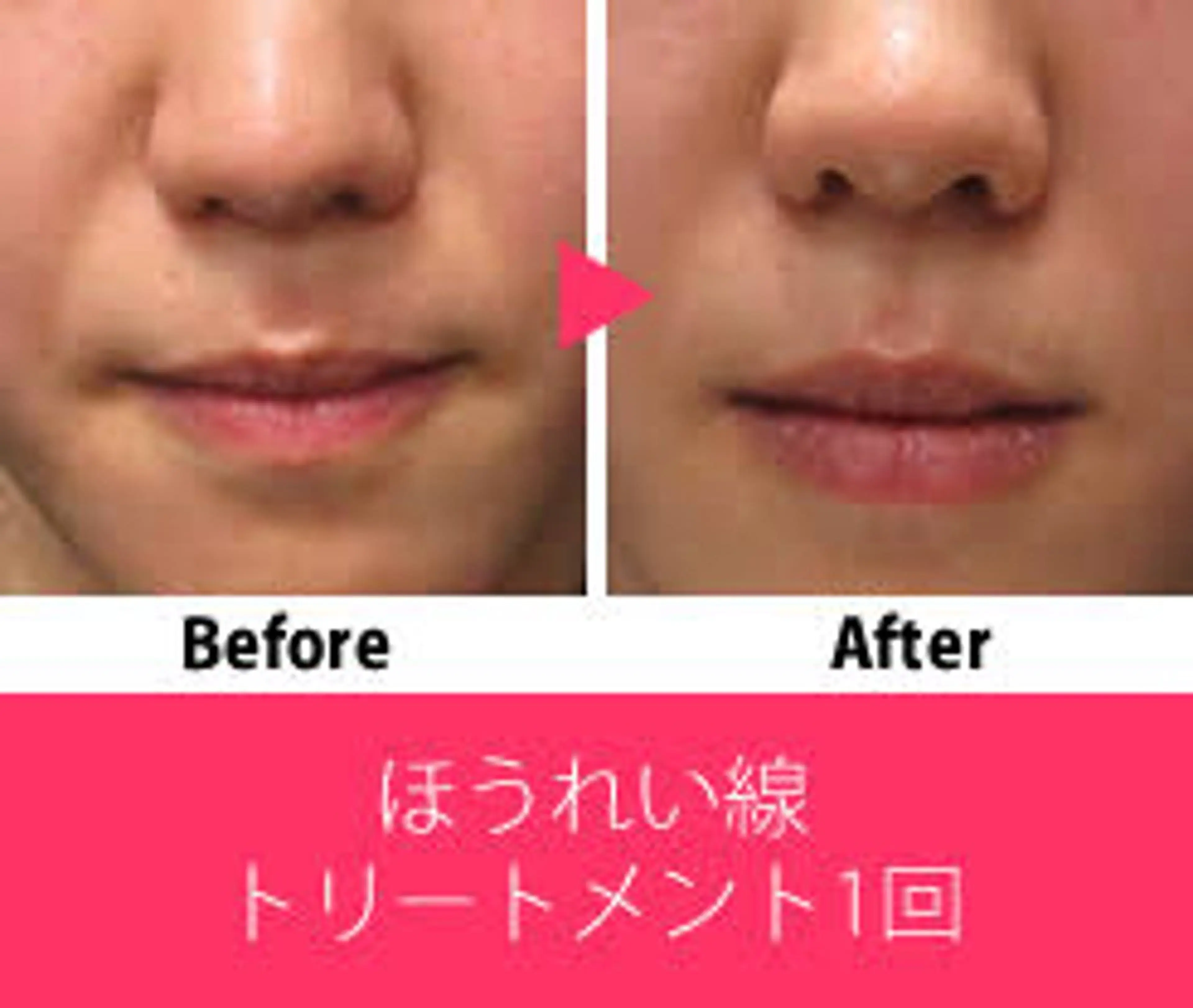 ビューティーラウンジ A&A✨佐藤✨のエステ・リラクイメージ