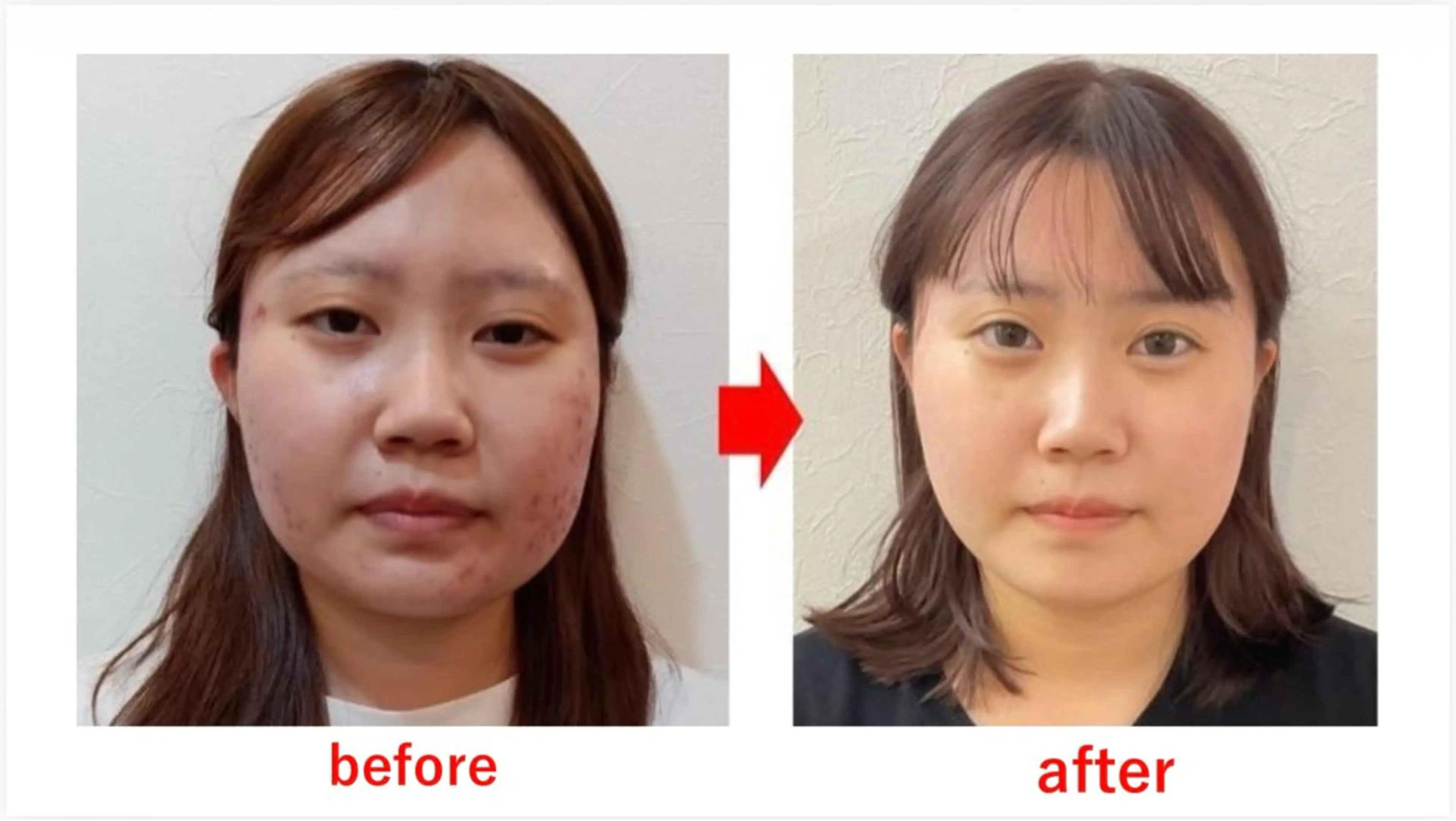 ブプラ 倉敷店のエステ・リラクイメージ