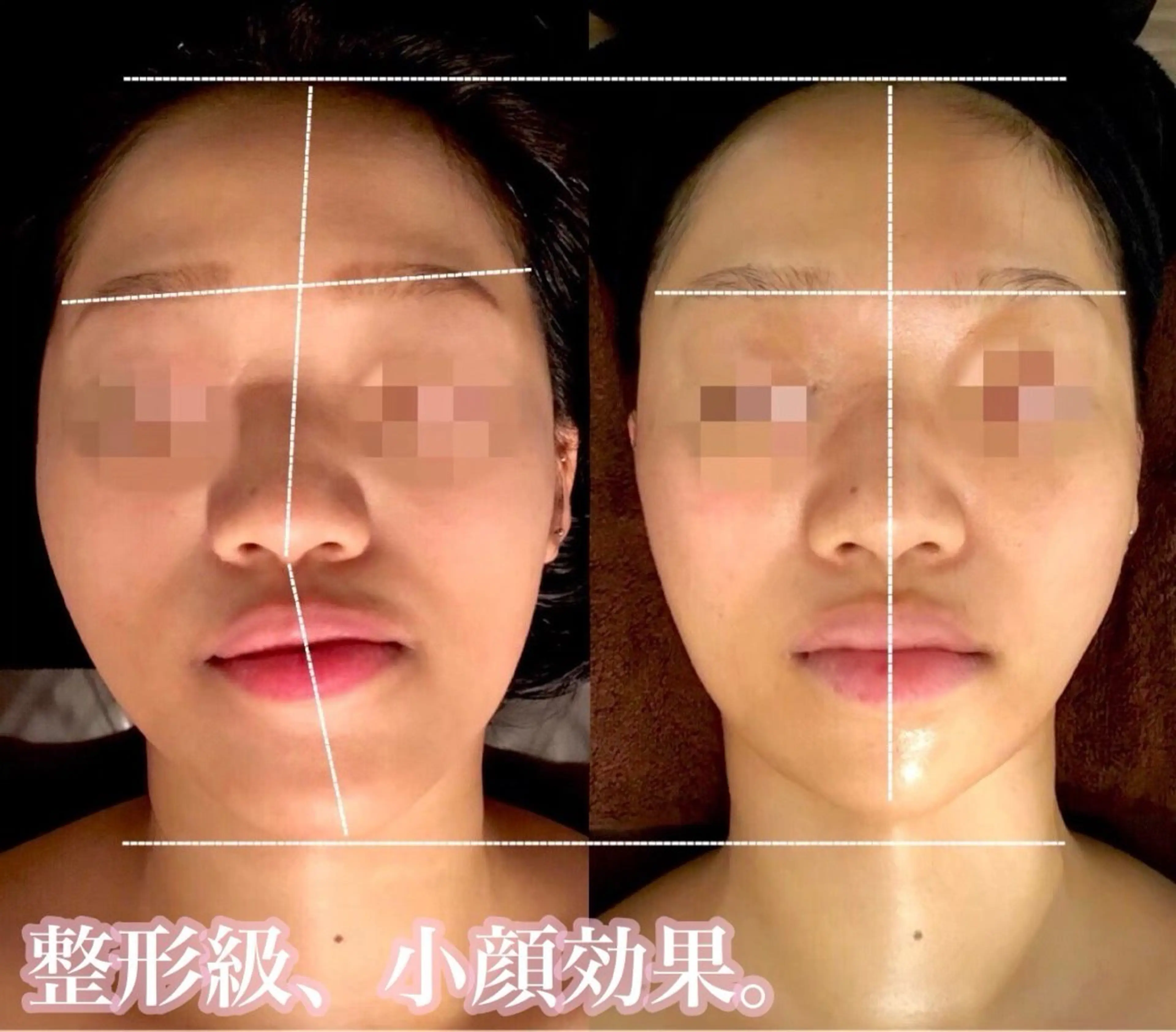 【男女共通/人気No.2】上半身ケア+小顔コルギ+選べるオプション80分 5,800円の写真