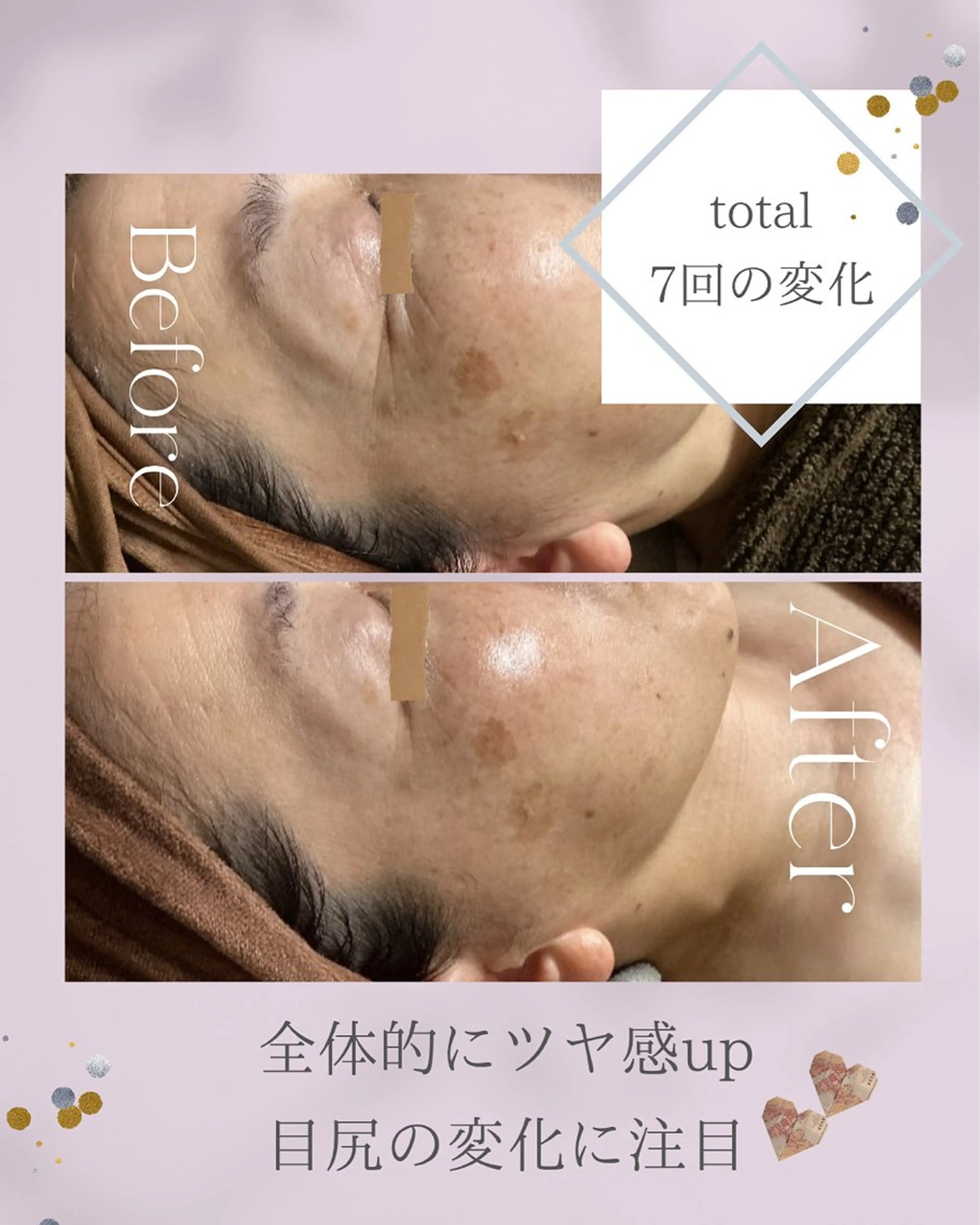 ainoa所属・ainoa アイノアのエステ・リラクイメージ