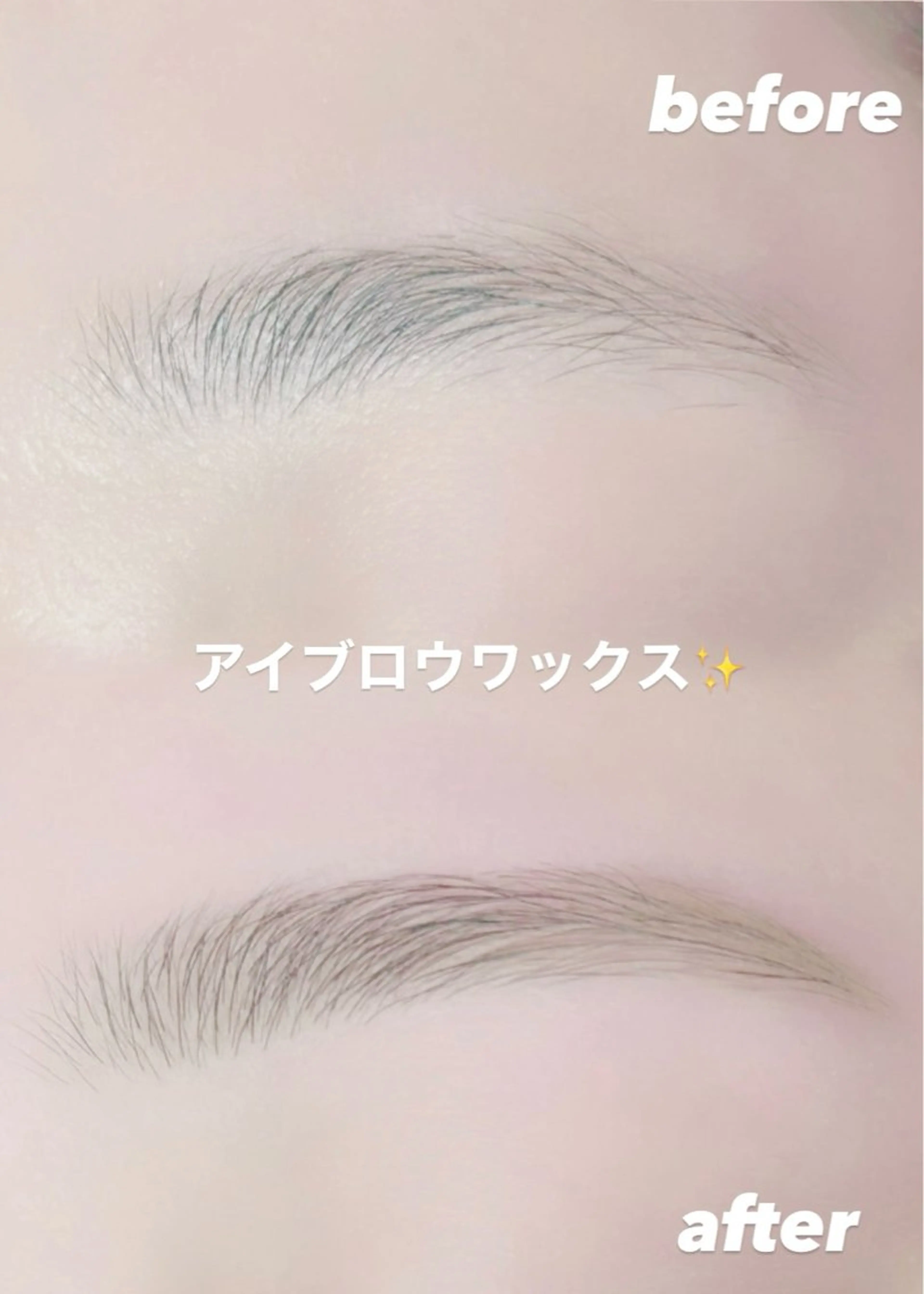 🩵アイブロウ🩵(眉毛)似合わせデザイン脱毛🌟の写真