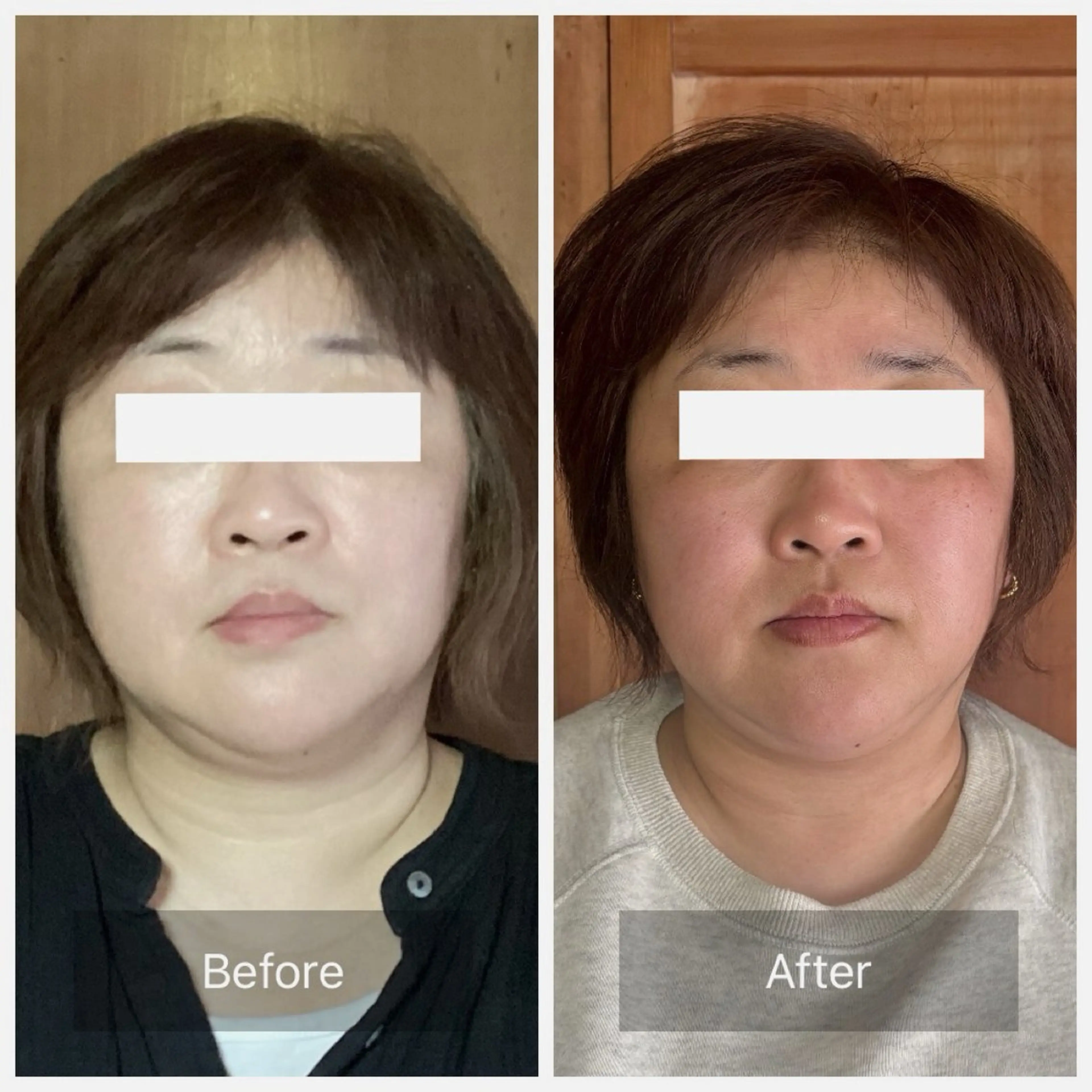 エステ リラク 小顔・歪み専門　井元 朋子のエステ・リラクイメージ