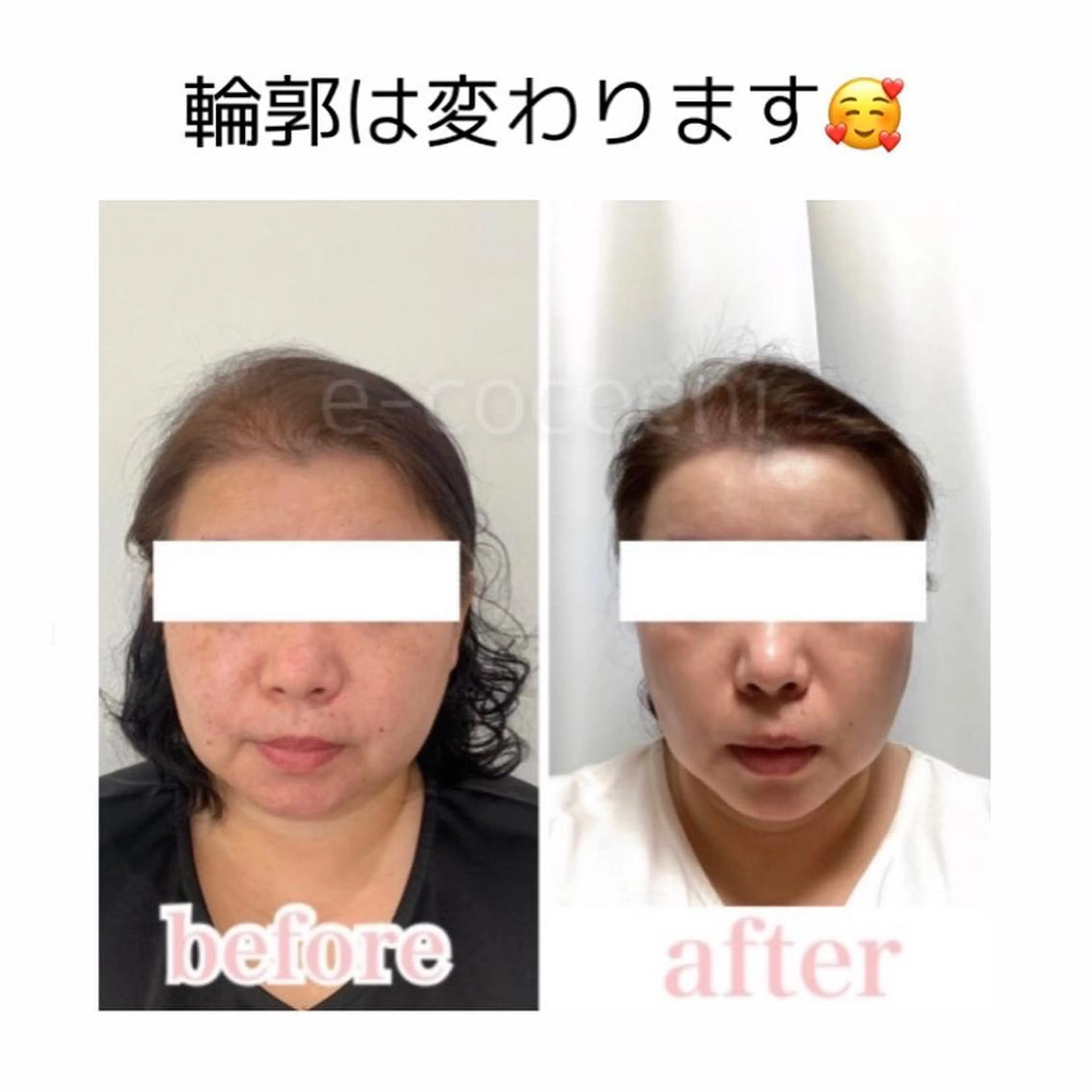 エステ リラク 小顔と ヘッドスパのお店のエステ・リラクイメージ