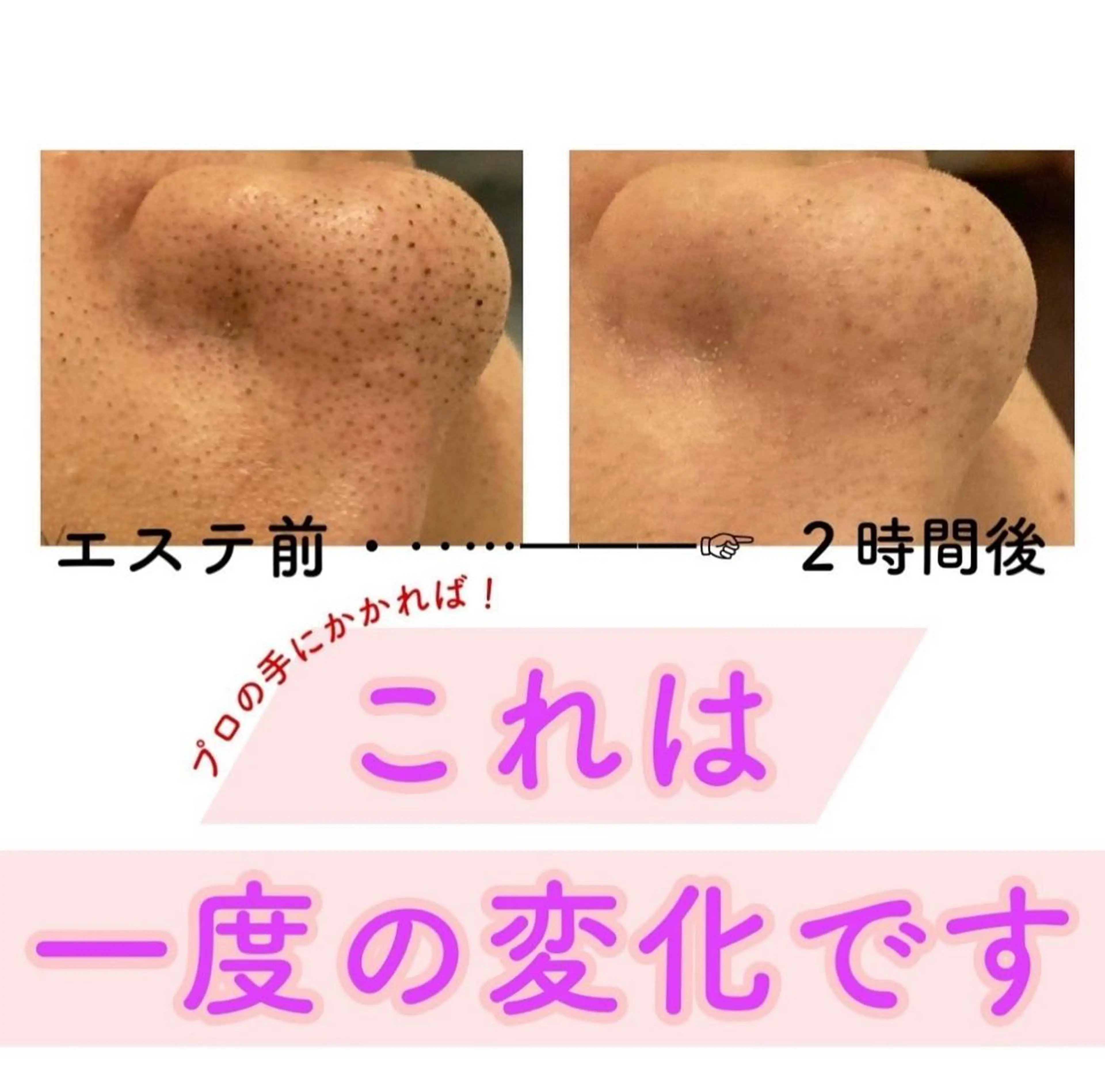 金の糸脱毛 産毛ケア専門のエステ・リラクイメージ