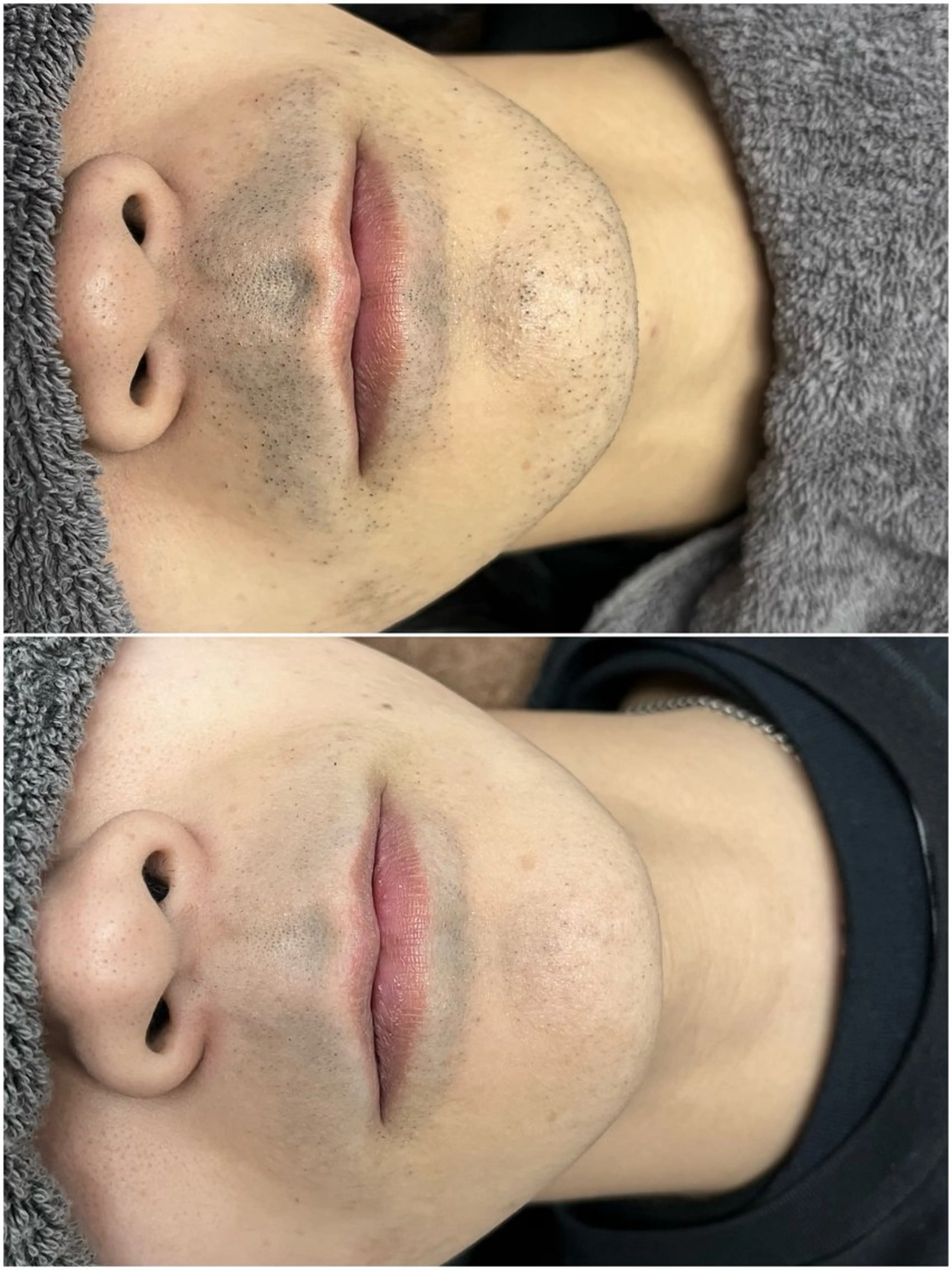 脱毛 Re:more 羽生のエステ・リラクイメージ