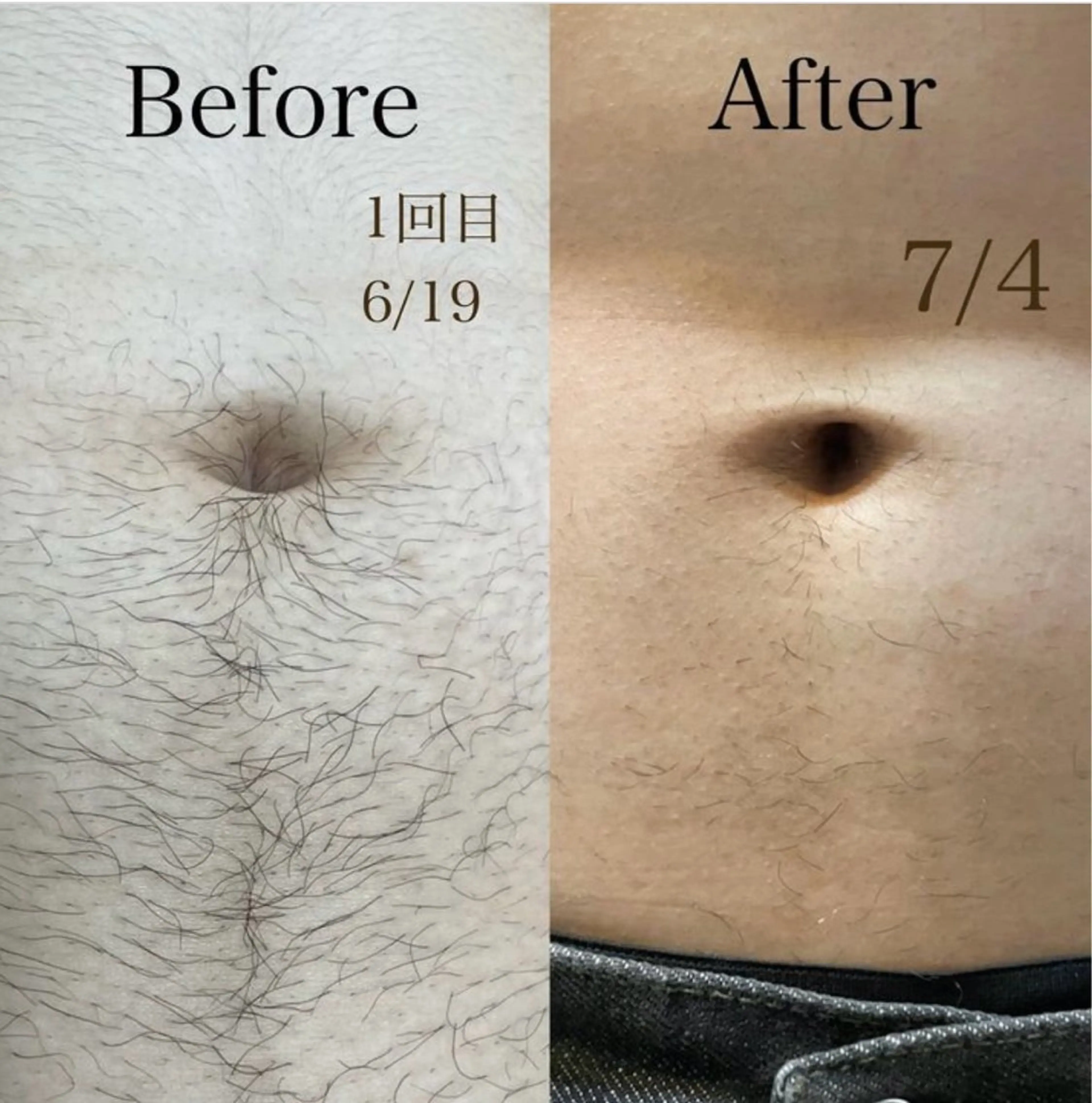 CARNA所属・【肌質改善専門店】 CARNAのエステ・リラクイメージ