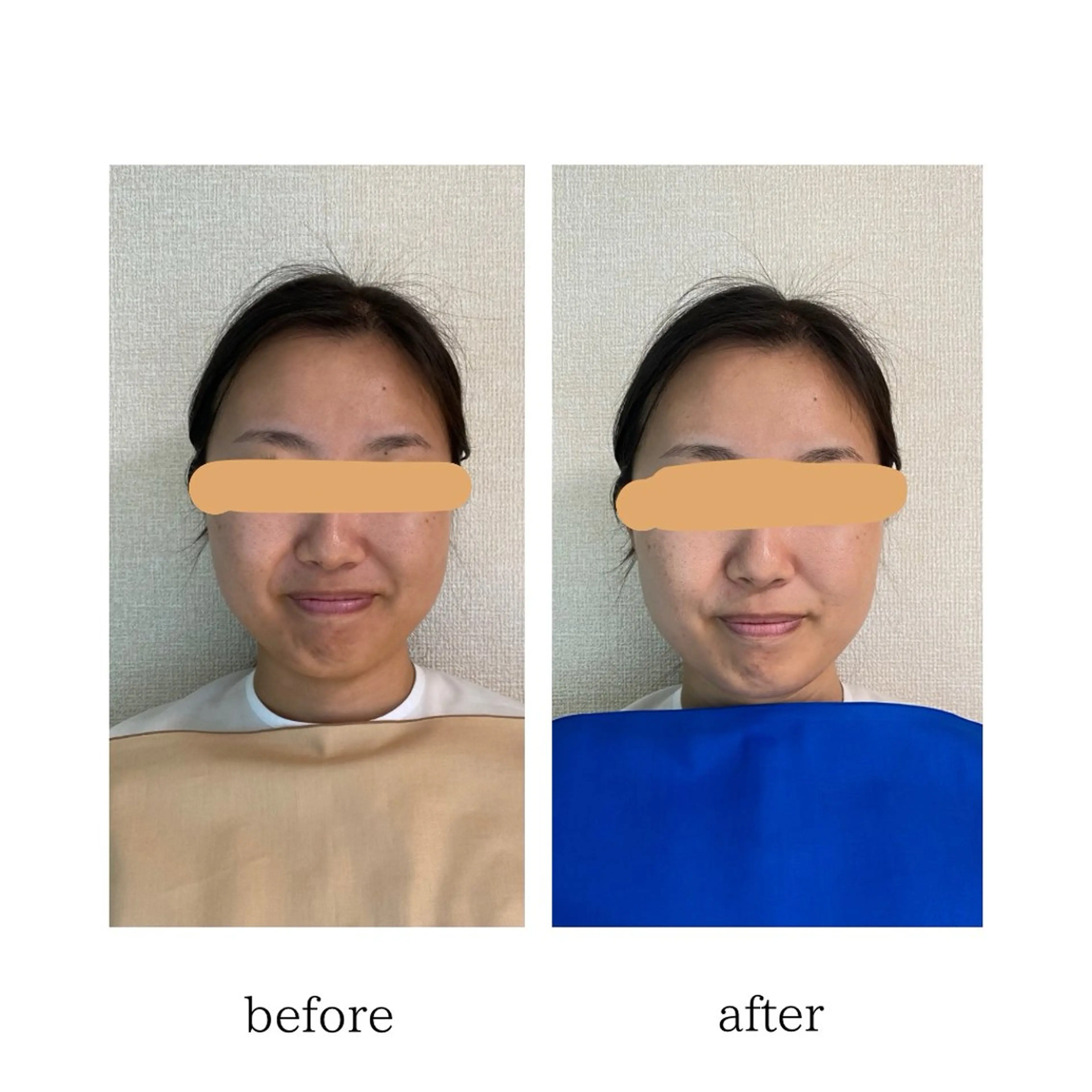 パーソナルカラー骨格 顔タイプ| Lisnのその他イメージ