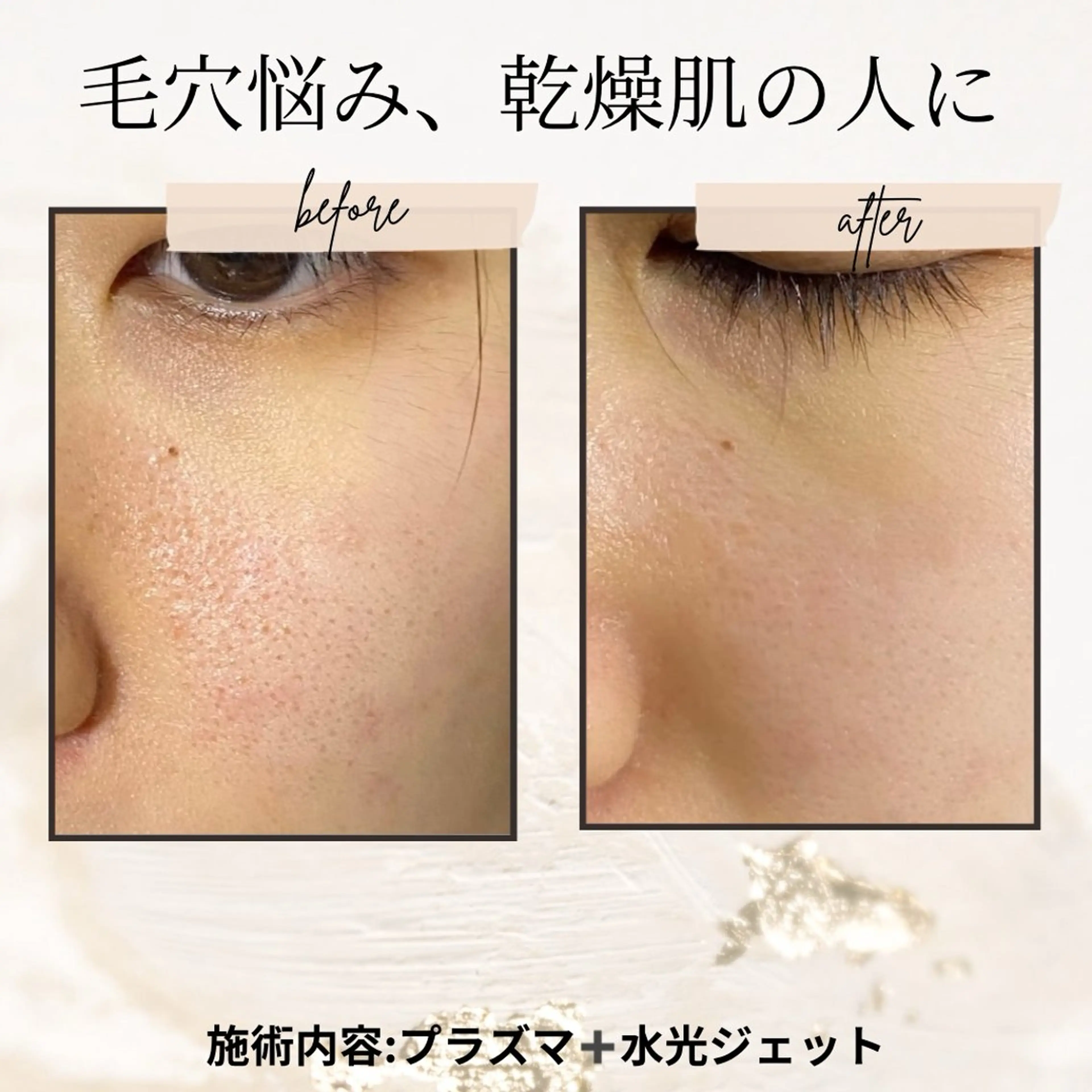 アイブロウ エステ リラク 愛維美水光美肌専門店 メンズレディースokのエステ・リラクイメージ