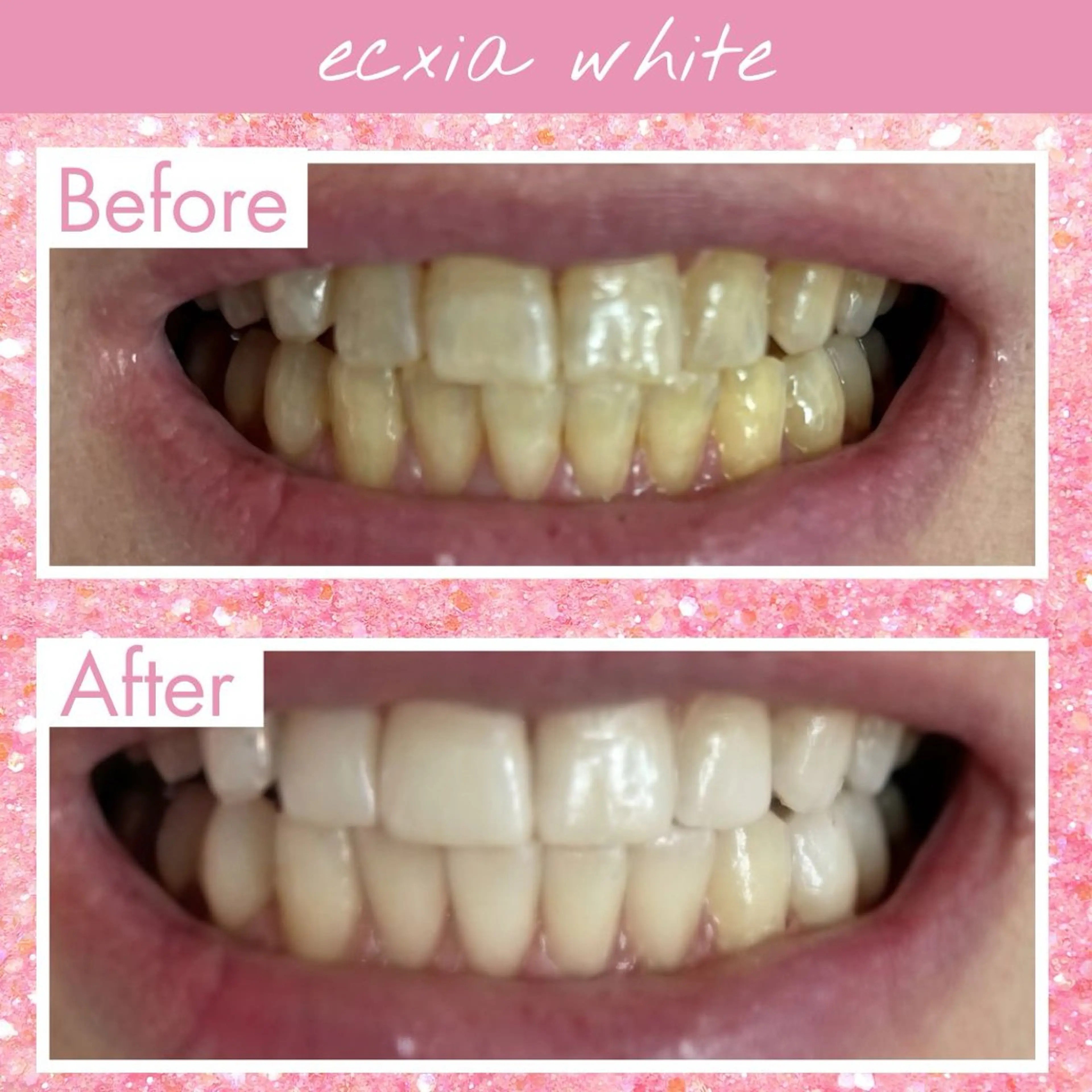 セルフホワイトニング エクシア宮崎花ヶ島店のその他イメージ