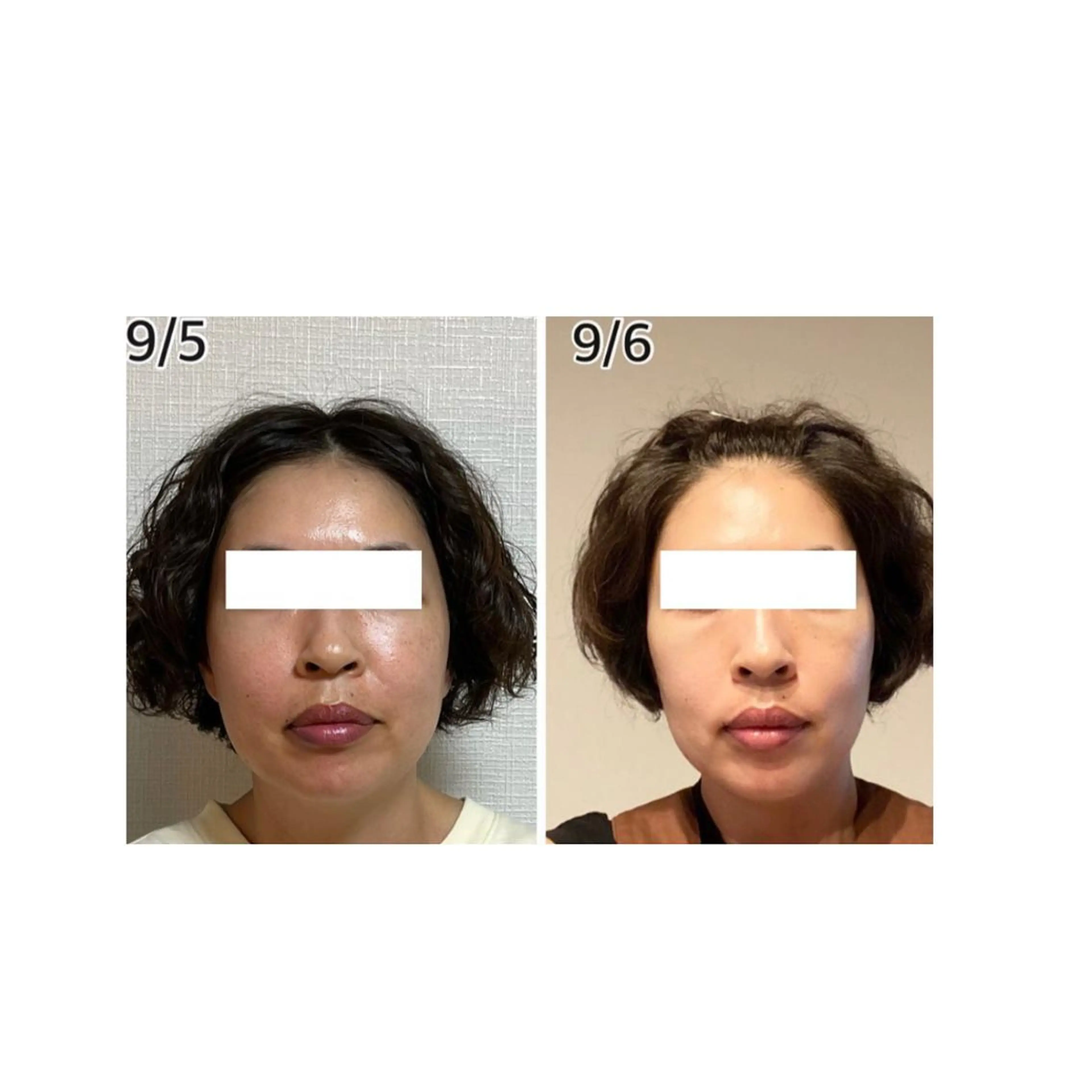 エステ リラク 小顔・毛穴専門 ルシェルのエステ・リラクイメージ