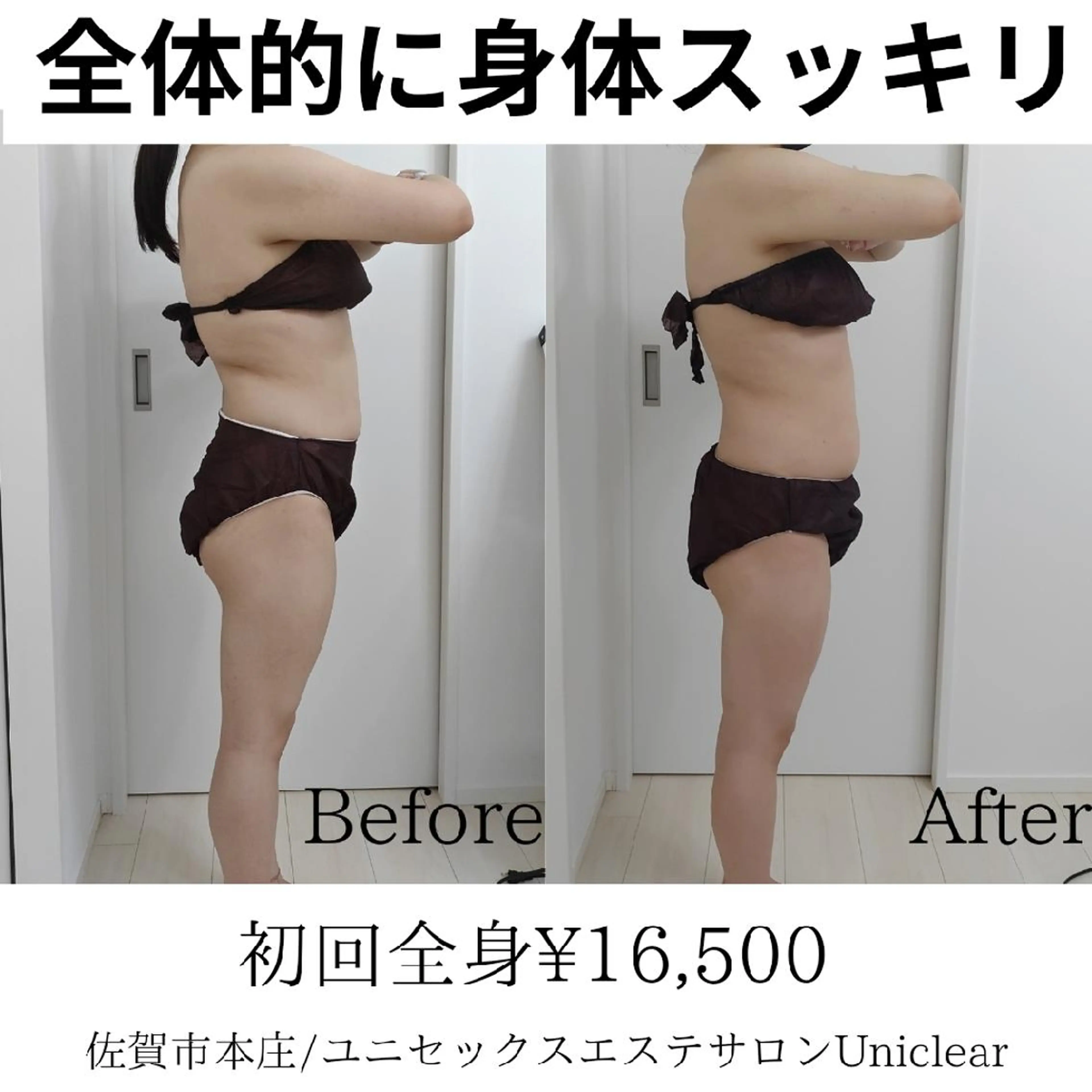 佐賀痩身エステ/小顔 @uni.clearのエステ・リラクイメージ