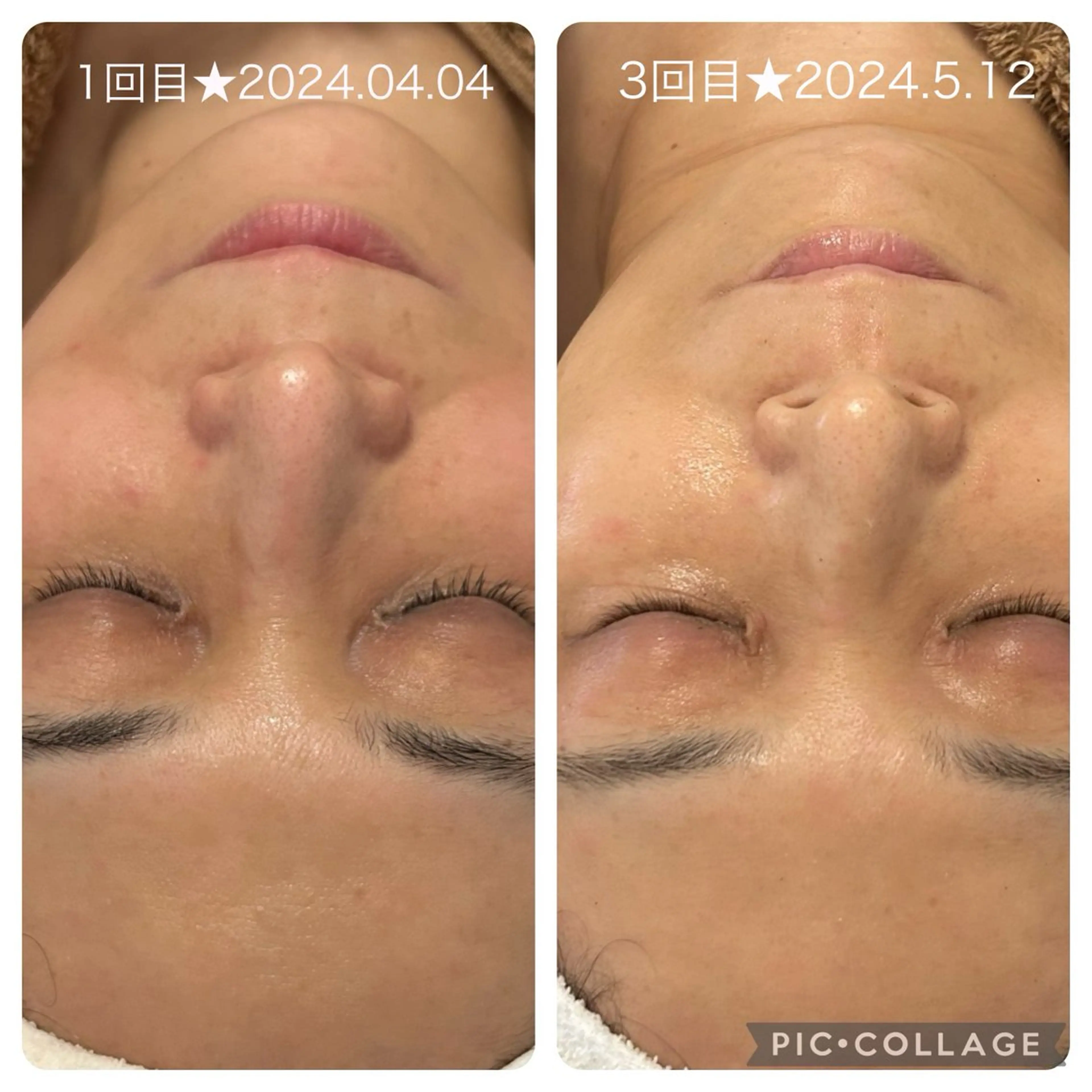 beauty salon mewのエステ・リラクイメージ