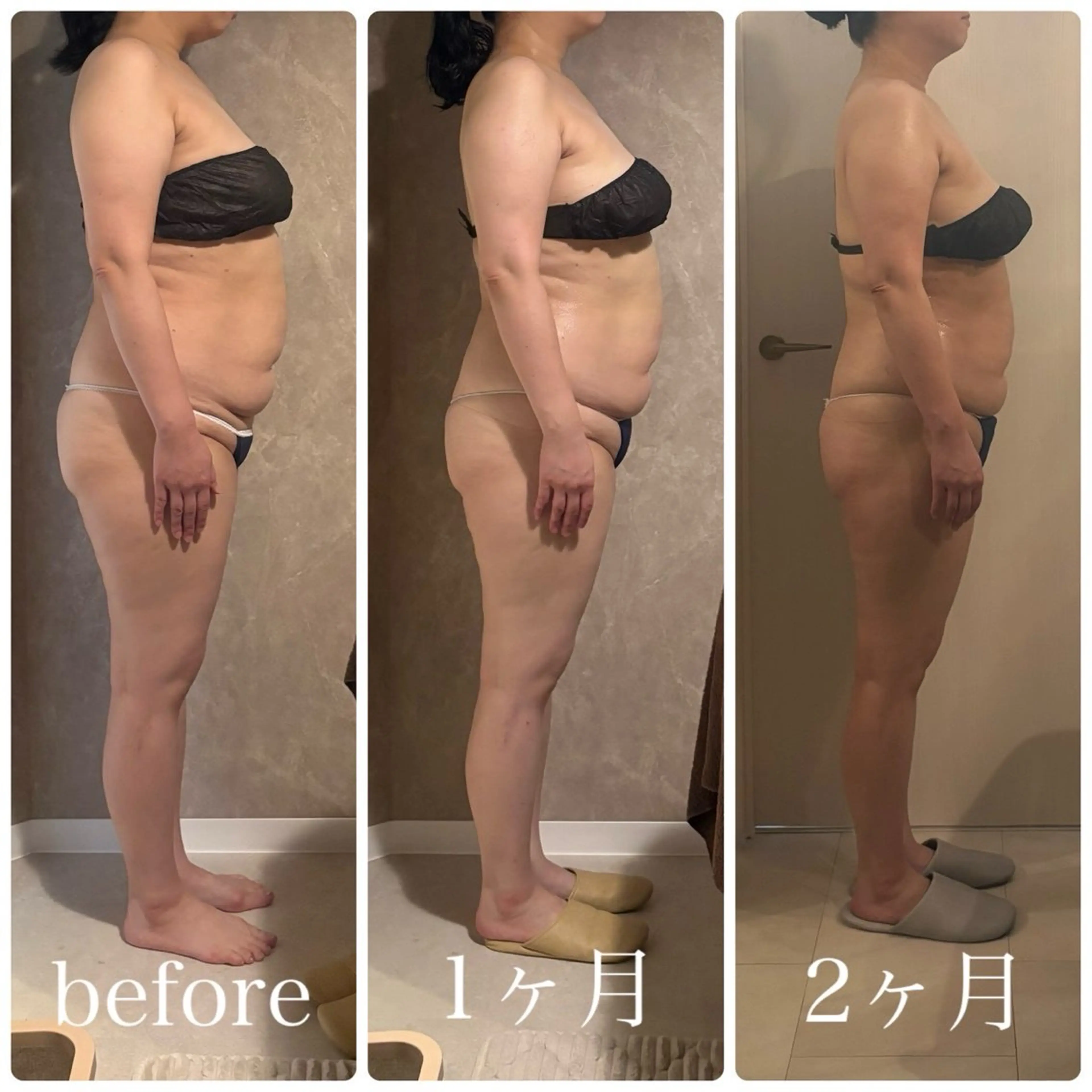 【セルゼロ】ダイエットコースの写真