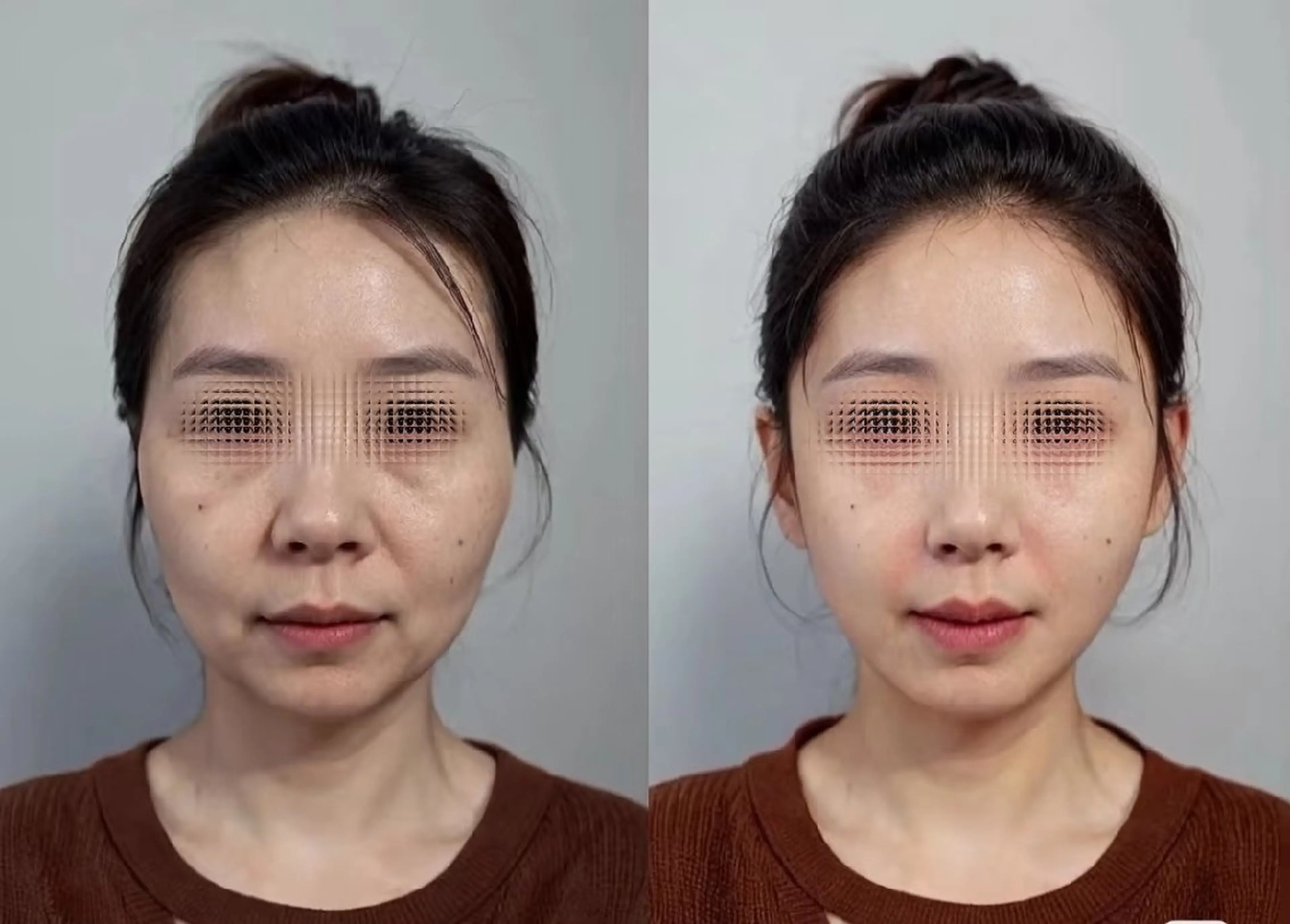 マツエク・マツパ 結婚式・ブライダル aliaハーブ水光店 エステティシャン募集のエステ・リラクイメージ