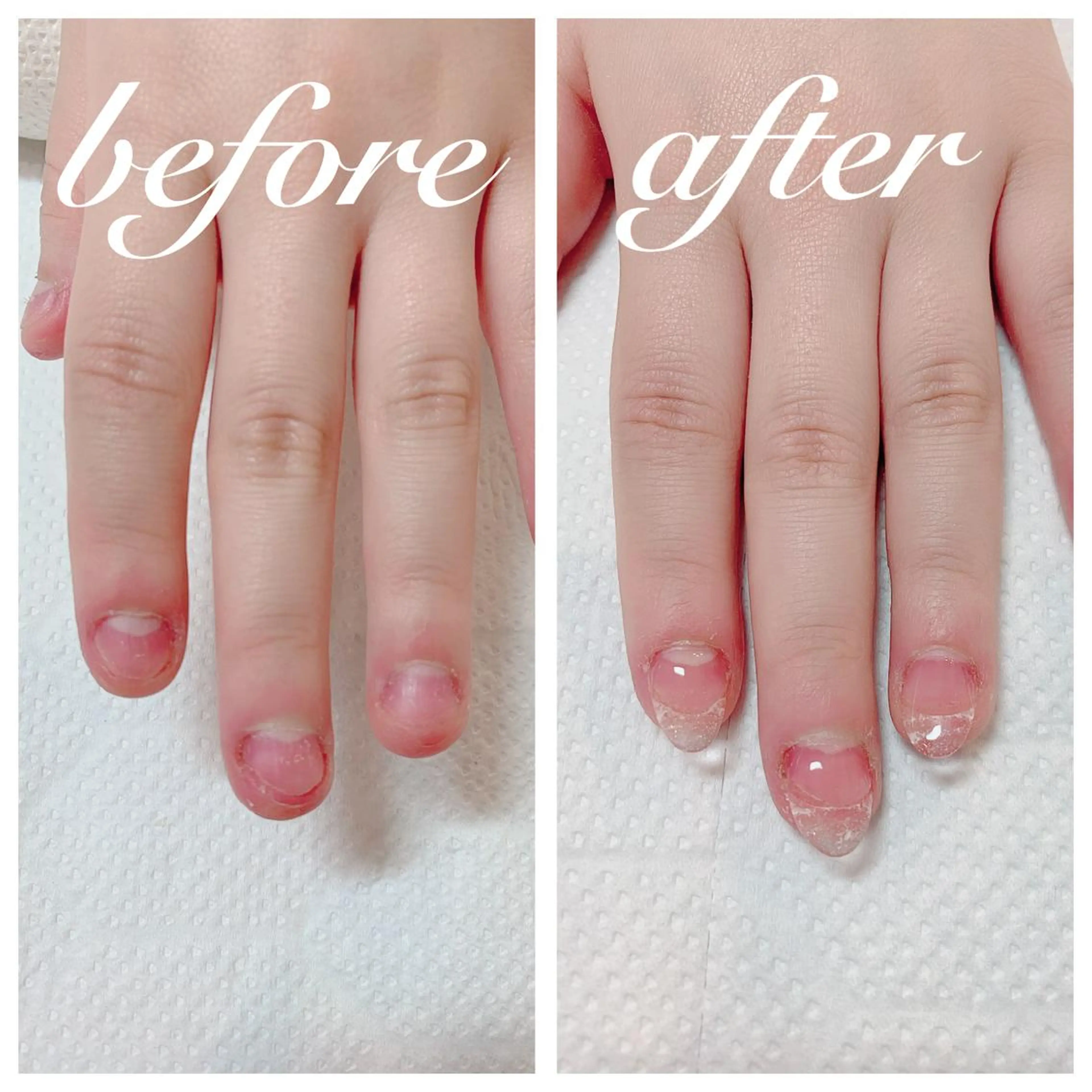 ネイル 長さ出し aoinail所属・aoi nailのネイルデザイン