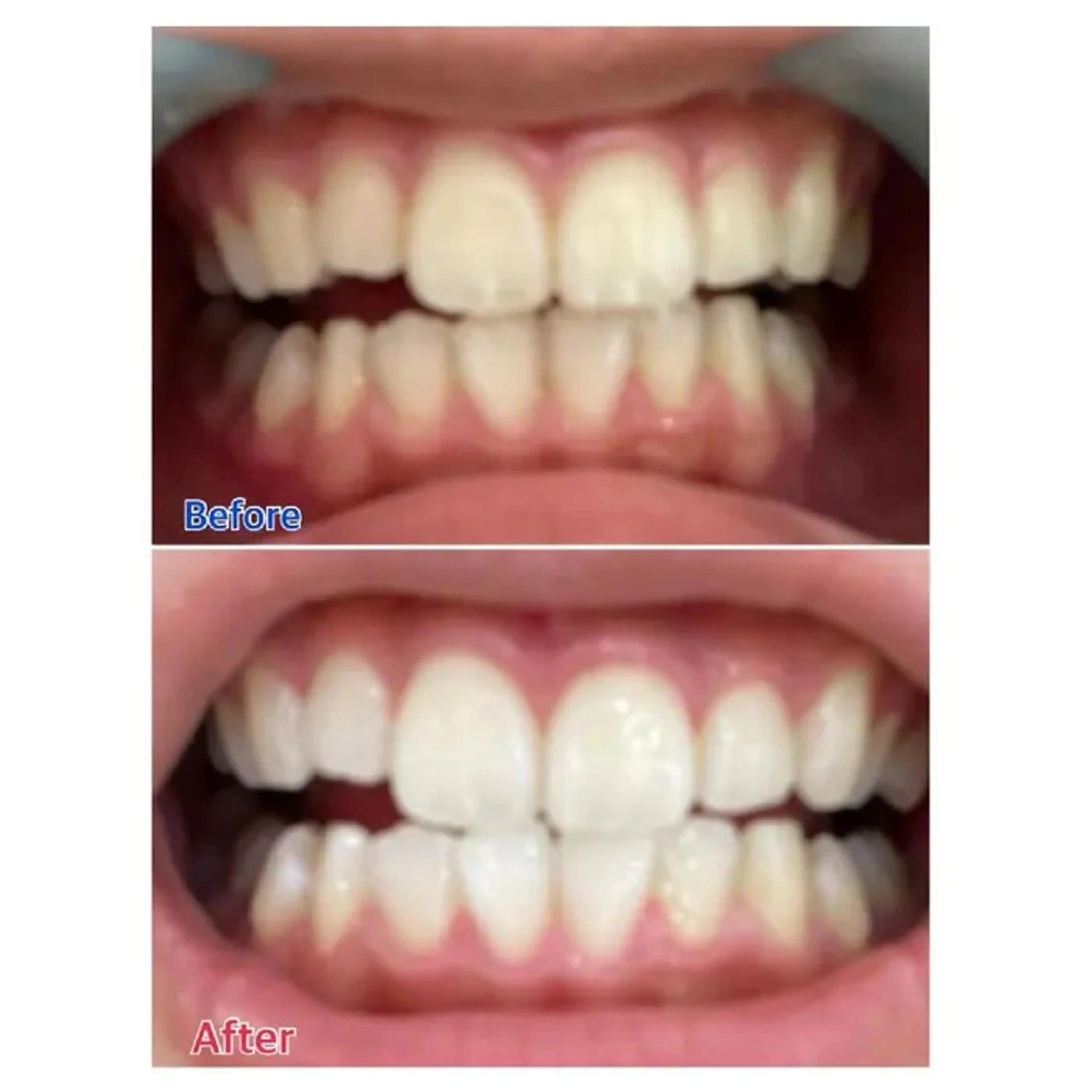 M渋谷 ホワイトニングのエステ・リラクイメージ