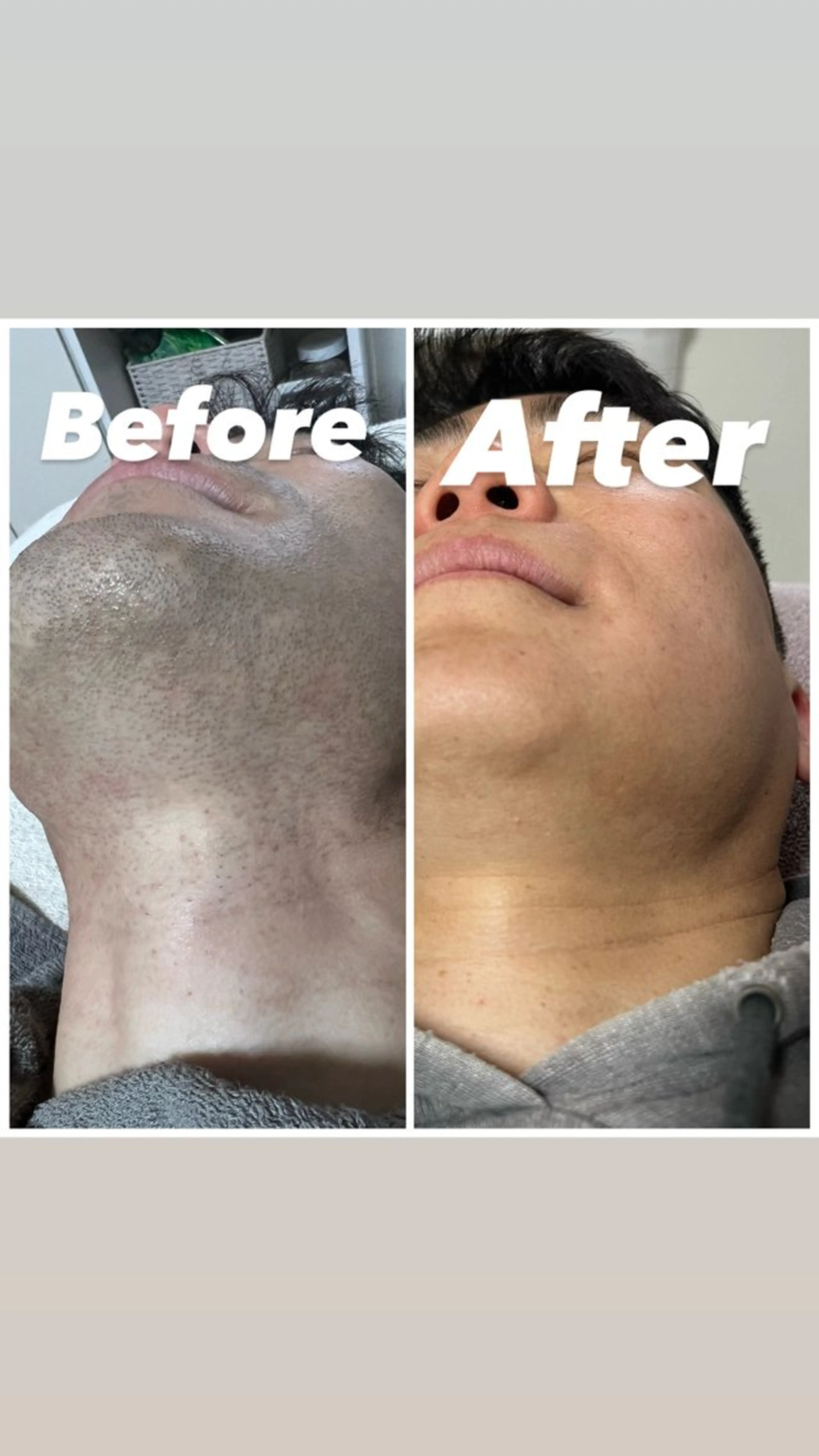 脱毛＆エステ　GLG 徳並のエステ・リラクイメージ