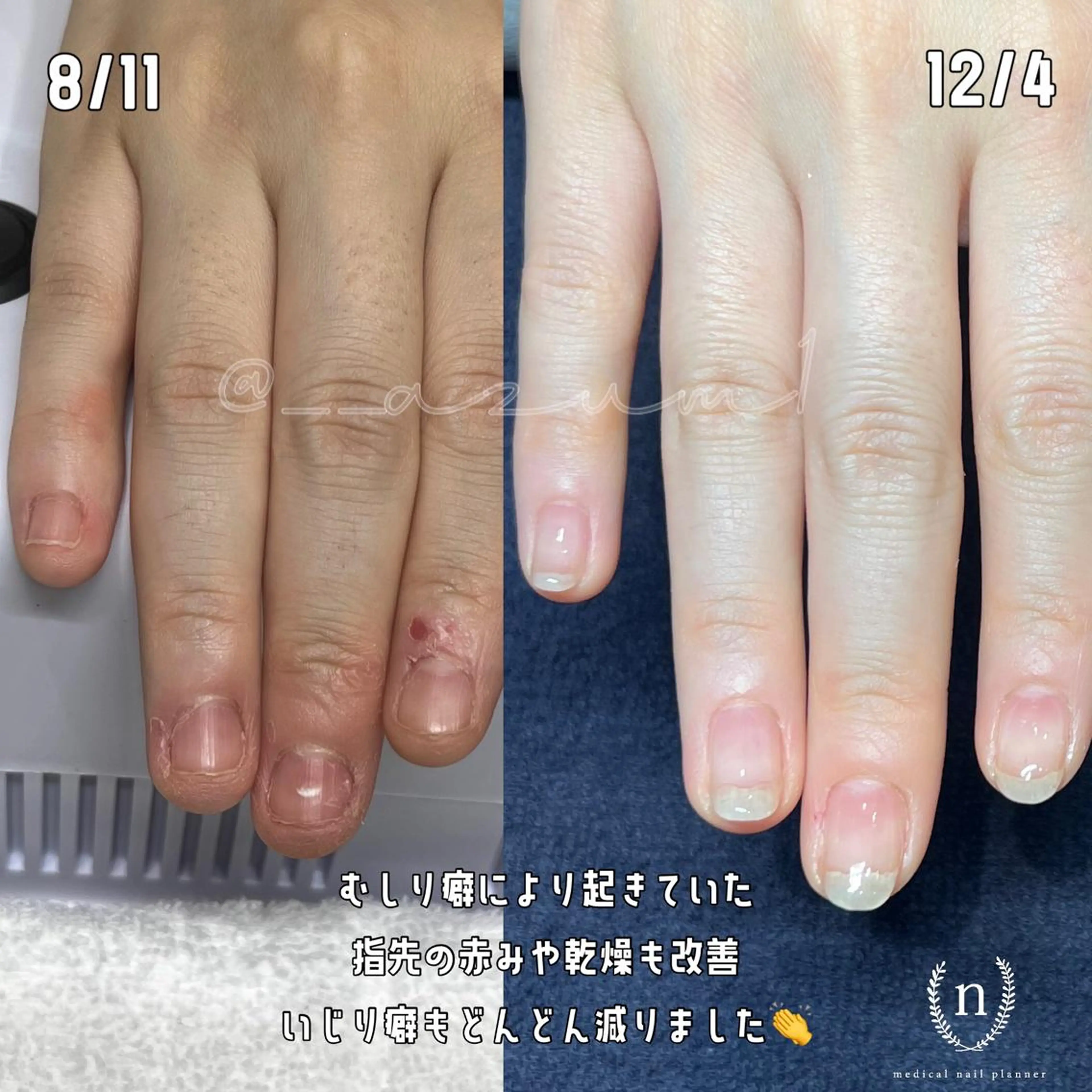 ネイル ハンドネイル 自爪育成専門サロン ◌𓈒azumiのネイルデザイン