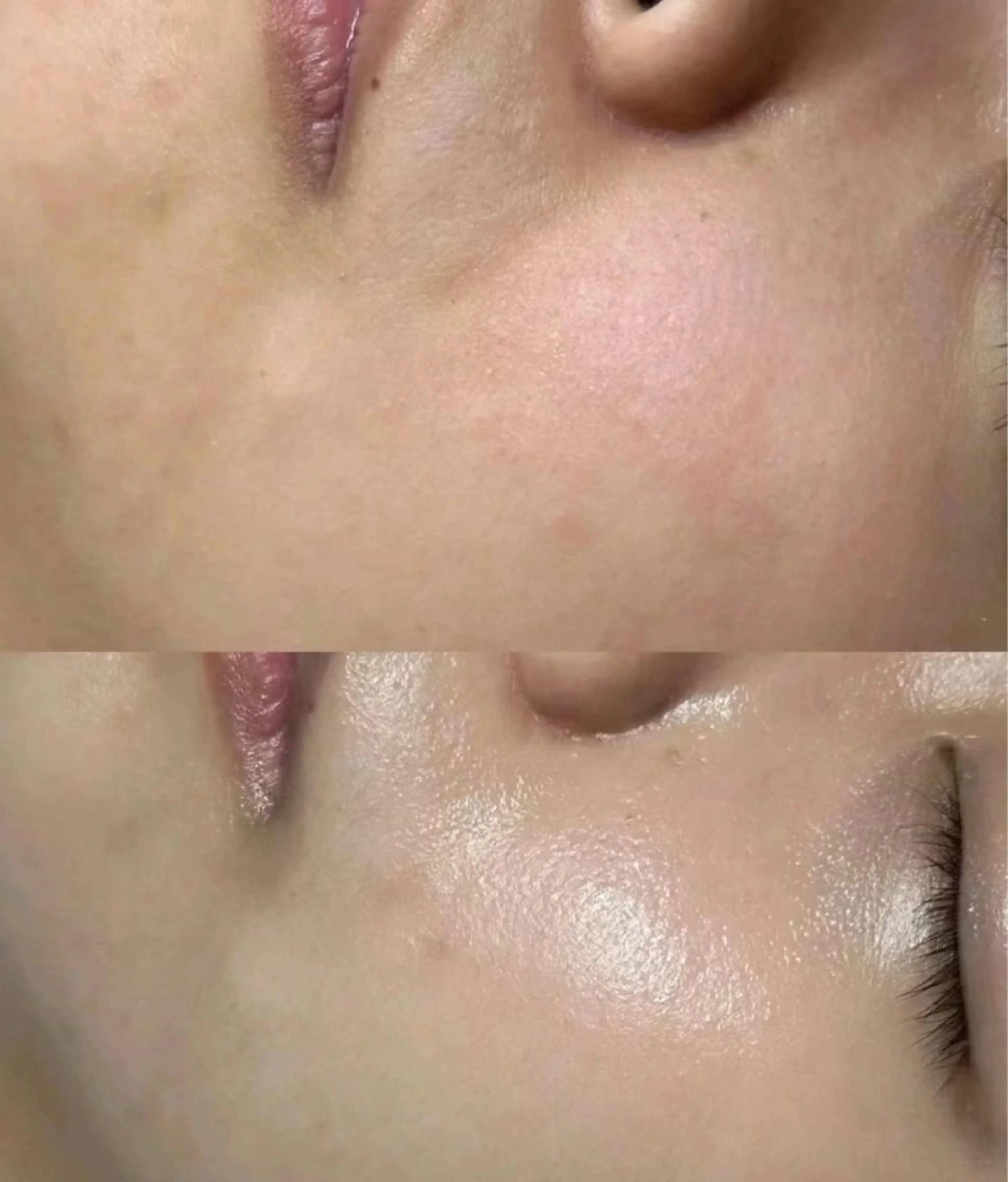 マツエク・マツパ エステ aliaハイフ&水光ジェットサロン所属・aliaハーブ水光店 エステティシャン募集のエステ・リラクイメージ