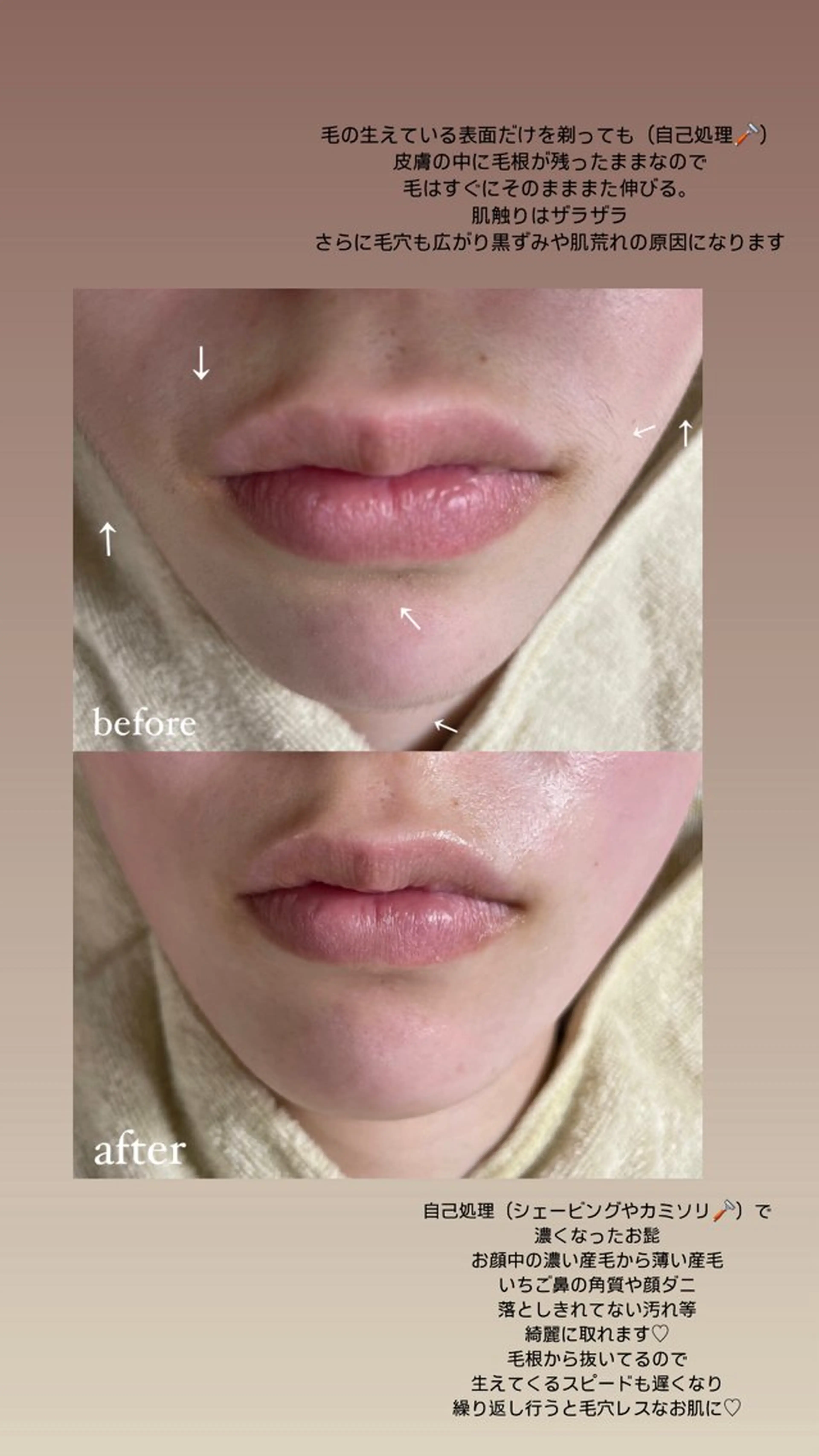 脱毛 エステサロン Mi-mi.iのエステ・リラクイメージ