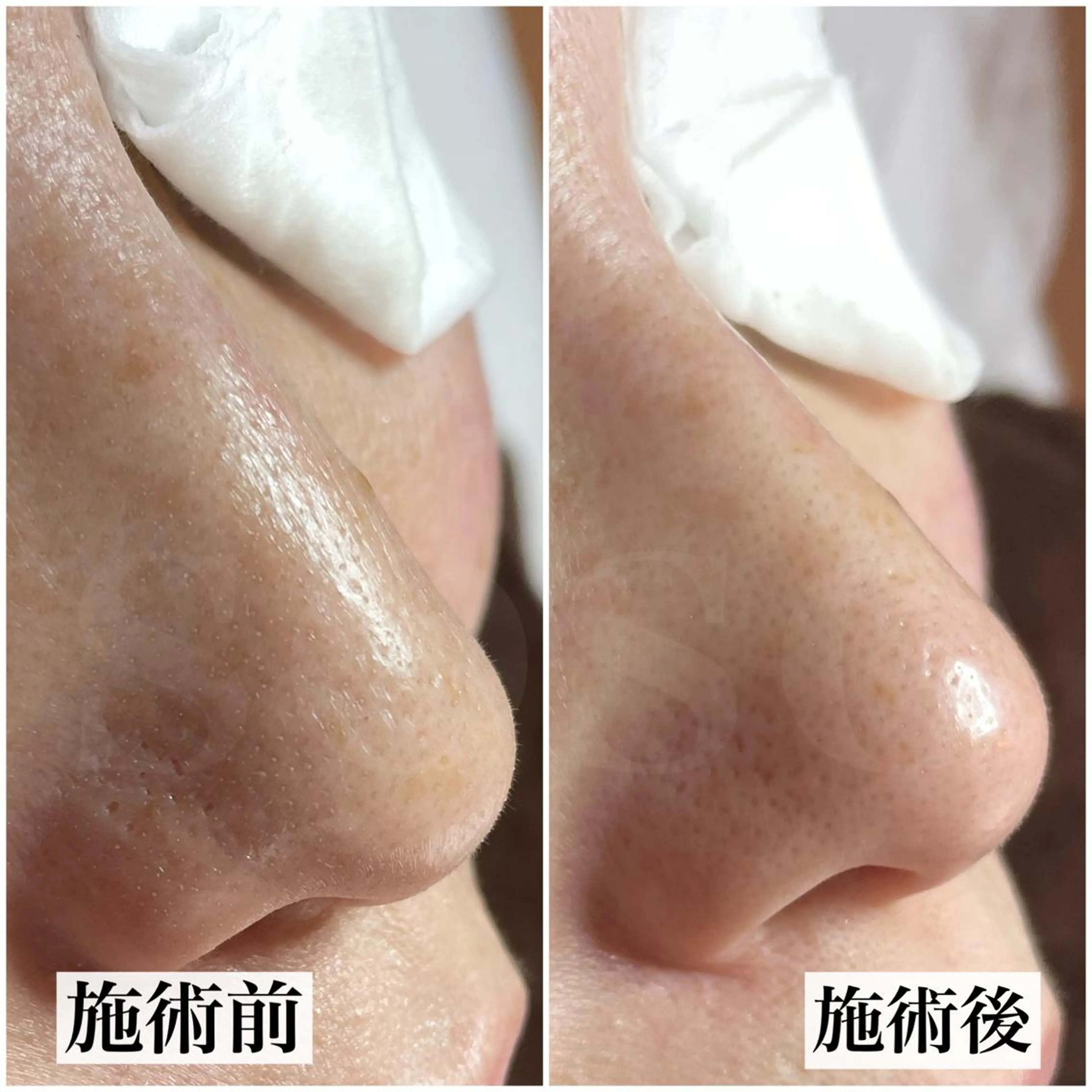 エステ salon soso(ソソ)のエステ・リラクイメージ