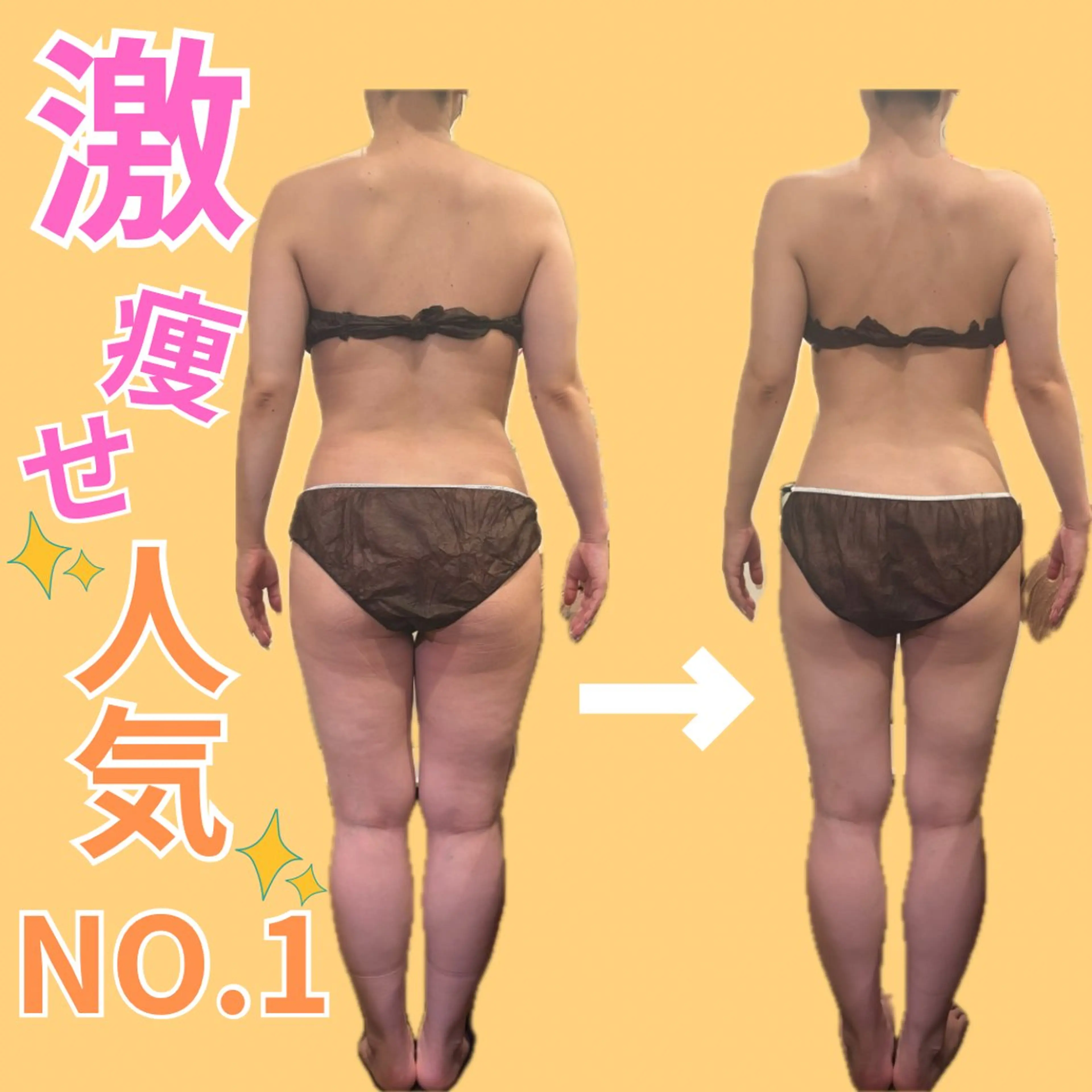 🌸人気NO.1深温TBバーニングコース🌸セルライト＆むくみ＆肩こり徹底解消🔥人生を変えるラストダイエット🥰の写真