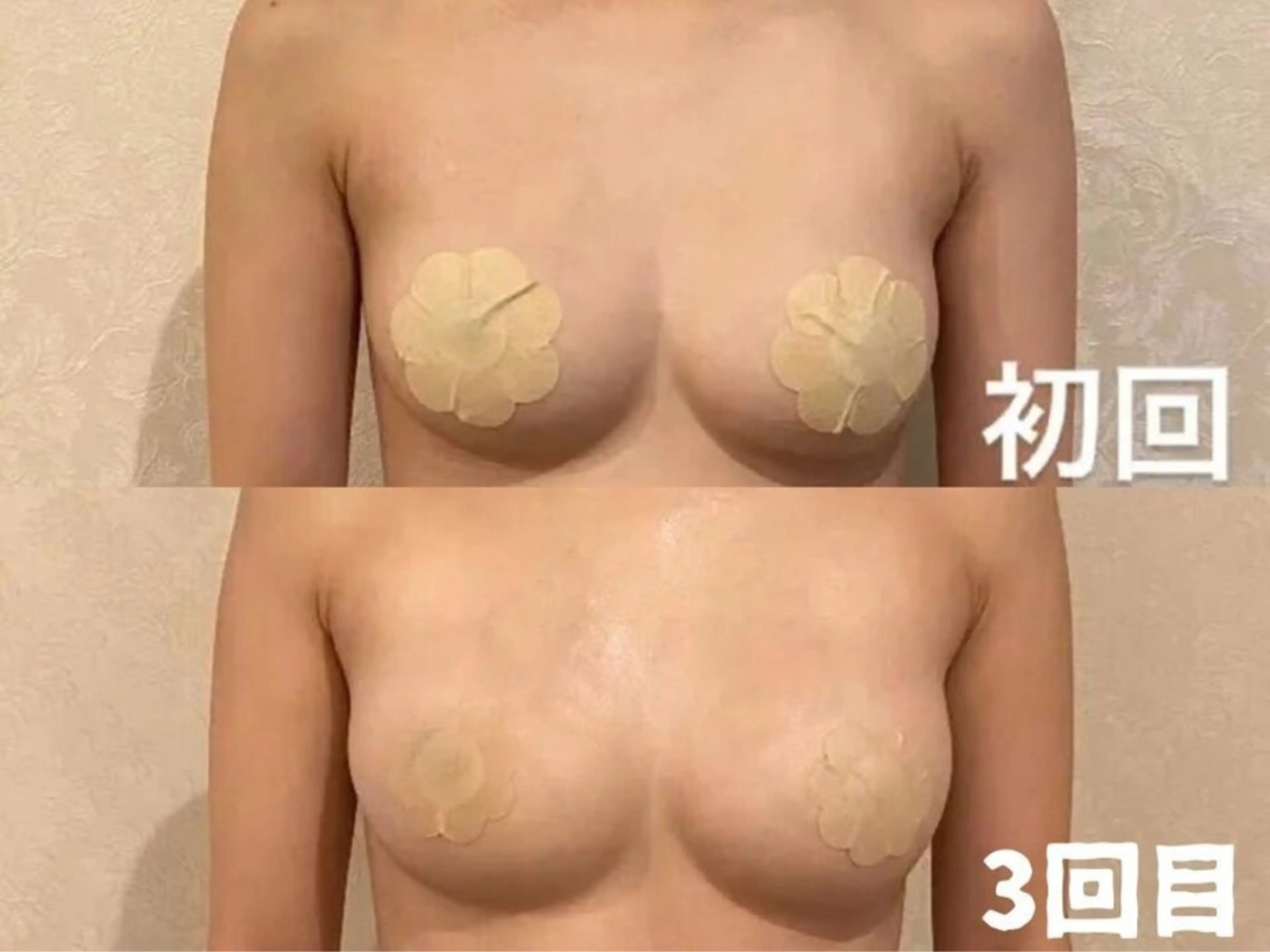 【限定モニタ10名様限定】バストアップ＋同じ金額施術3回まで60分　3980円の写真