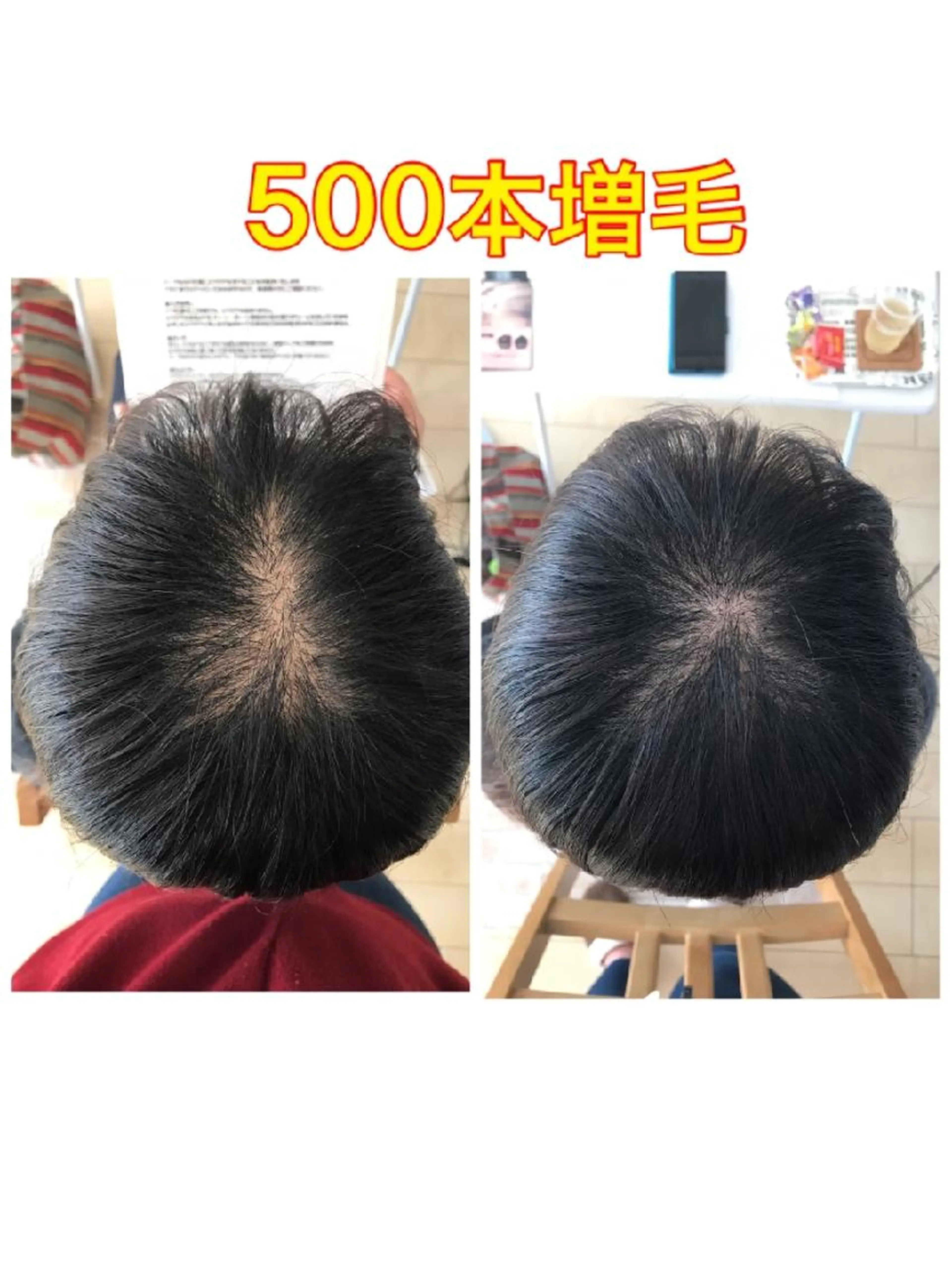 増毛エクステ500本お試し初回限定30%off(エアリーエクステ)男性も可の写真