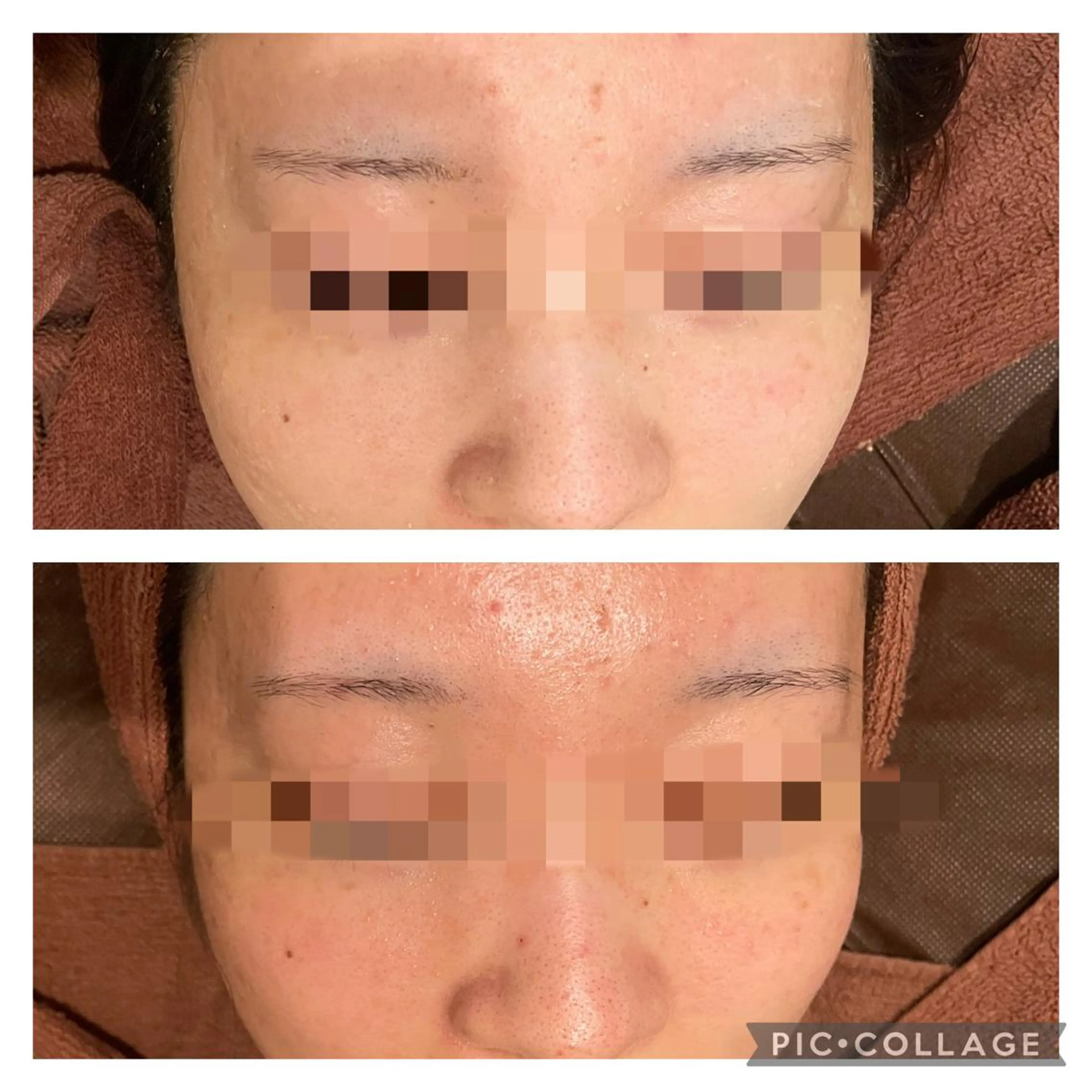 ミディアム カラー パーマ ヘアアレンジ メンズ キッズ ネイル マツエク・マツパ アイブロウ エステ リラク ニキビ特化型エステ 🍋最短で肌質改善のエステ・リラクイメージ