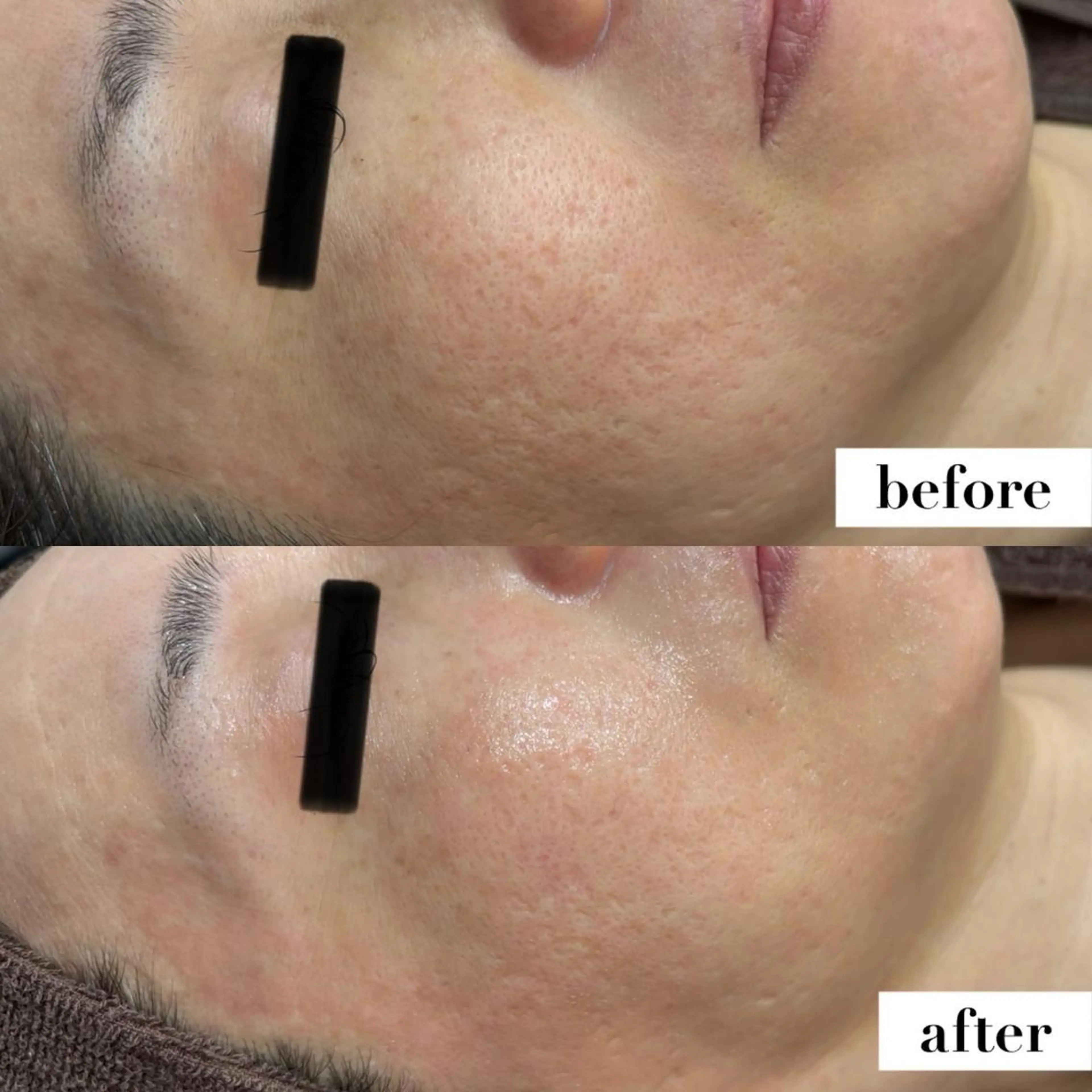 BLESS BEAUTYのエステ・リラクイメージ