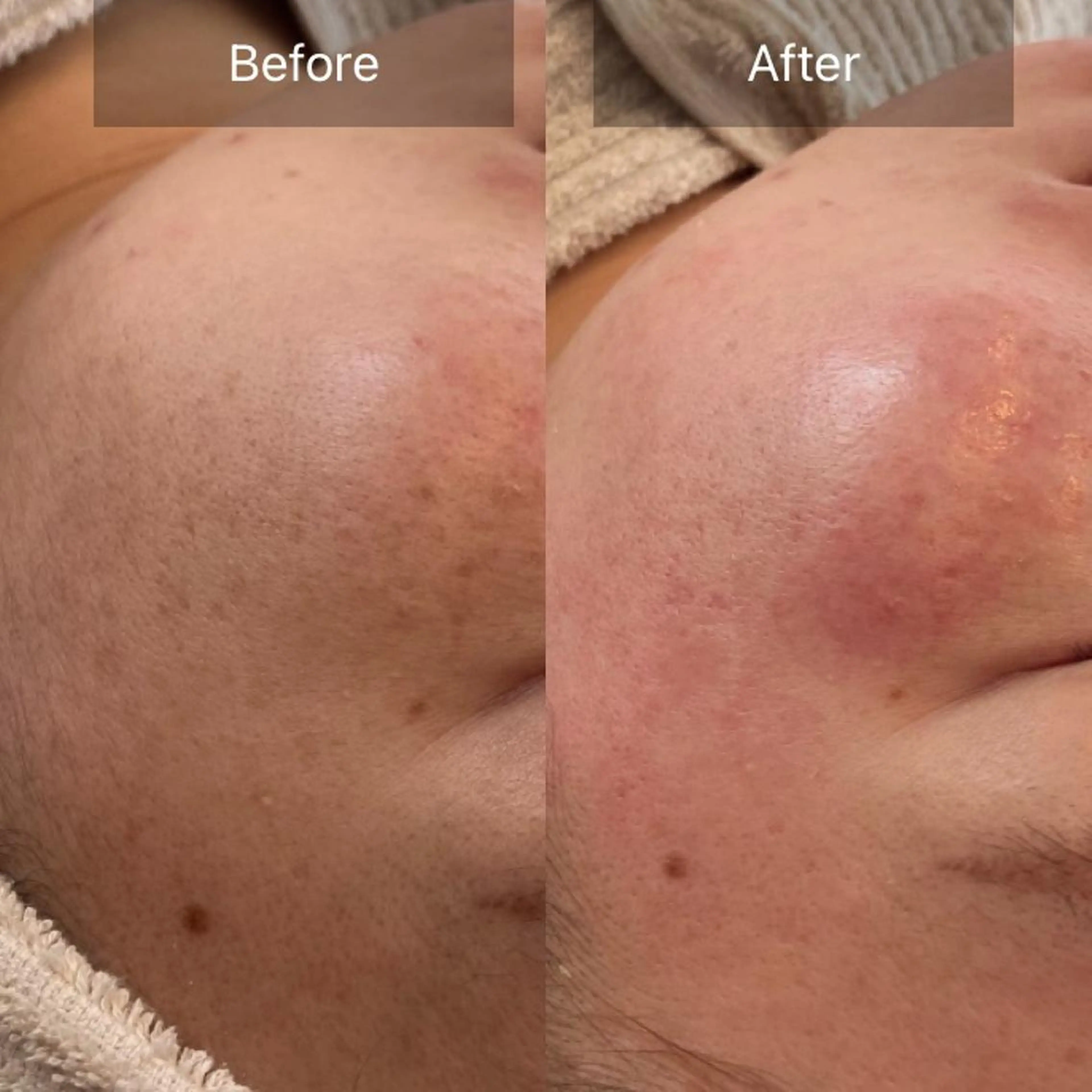 お体➕お肌のメンテナンスが同時が実現❗️脳洗浄ヘッドマッサージ60分(通常11000円)❌艶肌wax(通常11000円)の写真