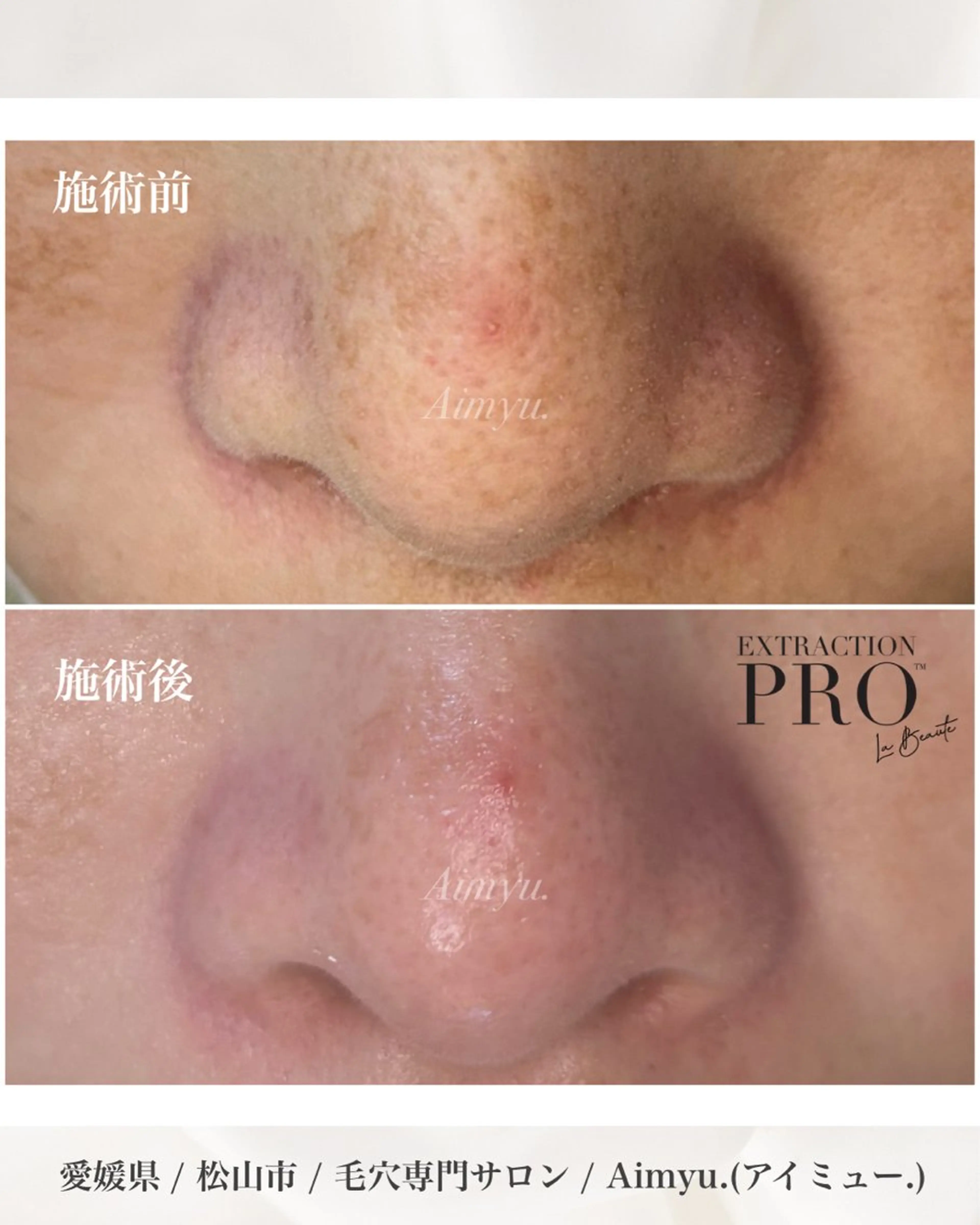 毛穴専門店アイミュー mamiのエステ・リラクイメージ