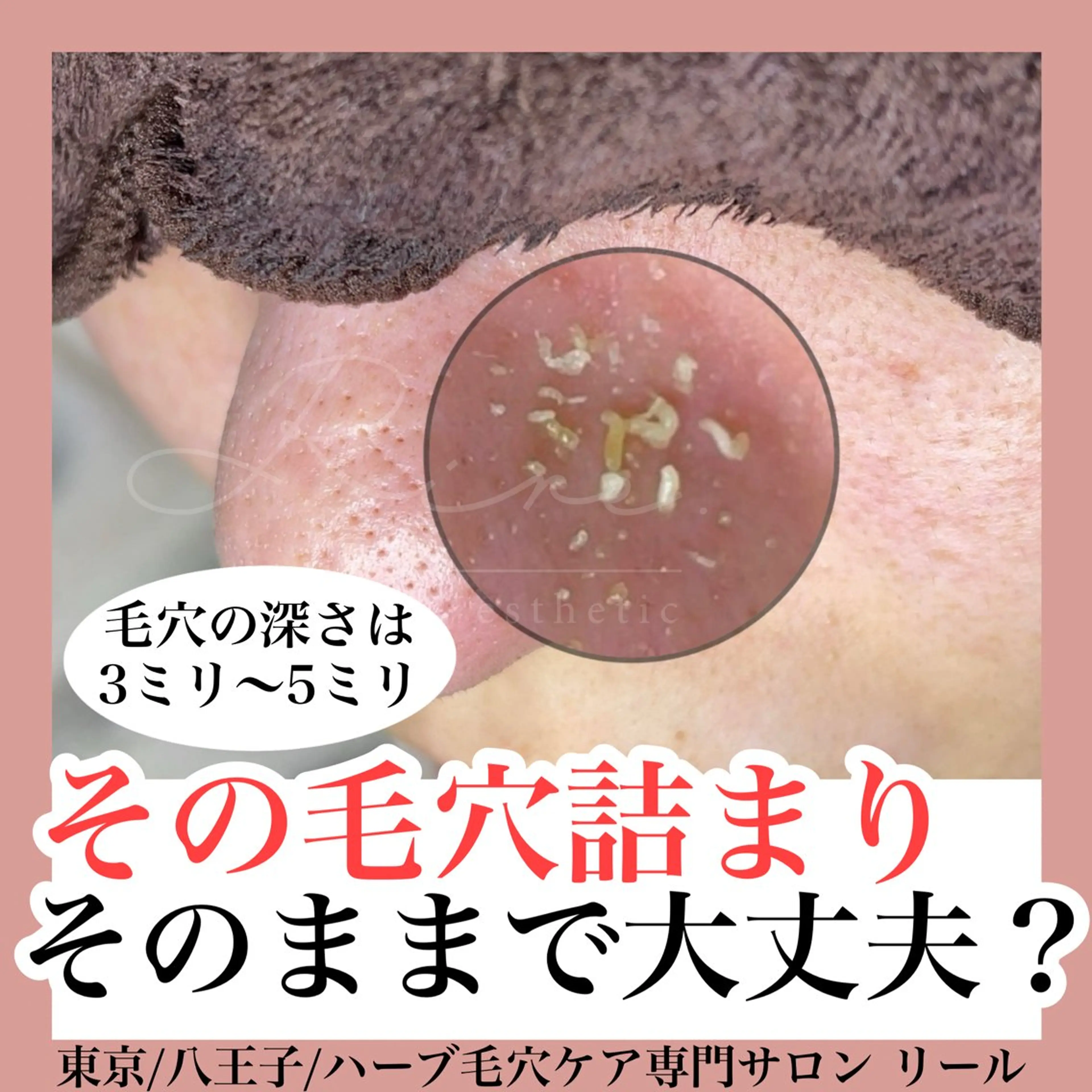 毛穴特化エステ -リールのエステ・リラクイメージ