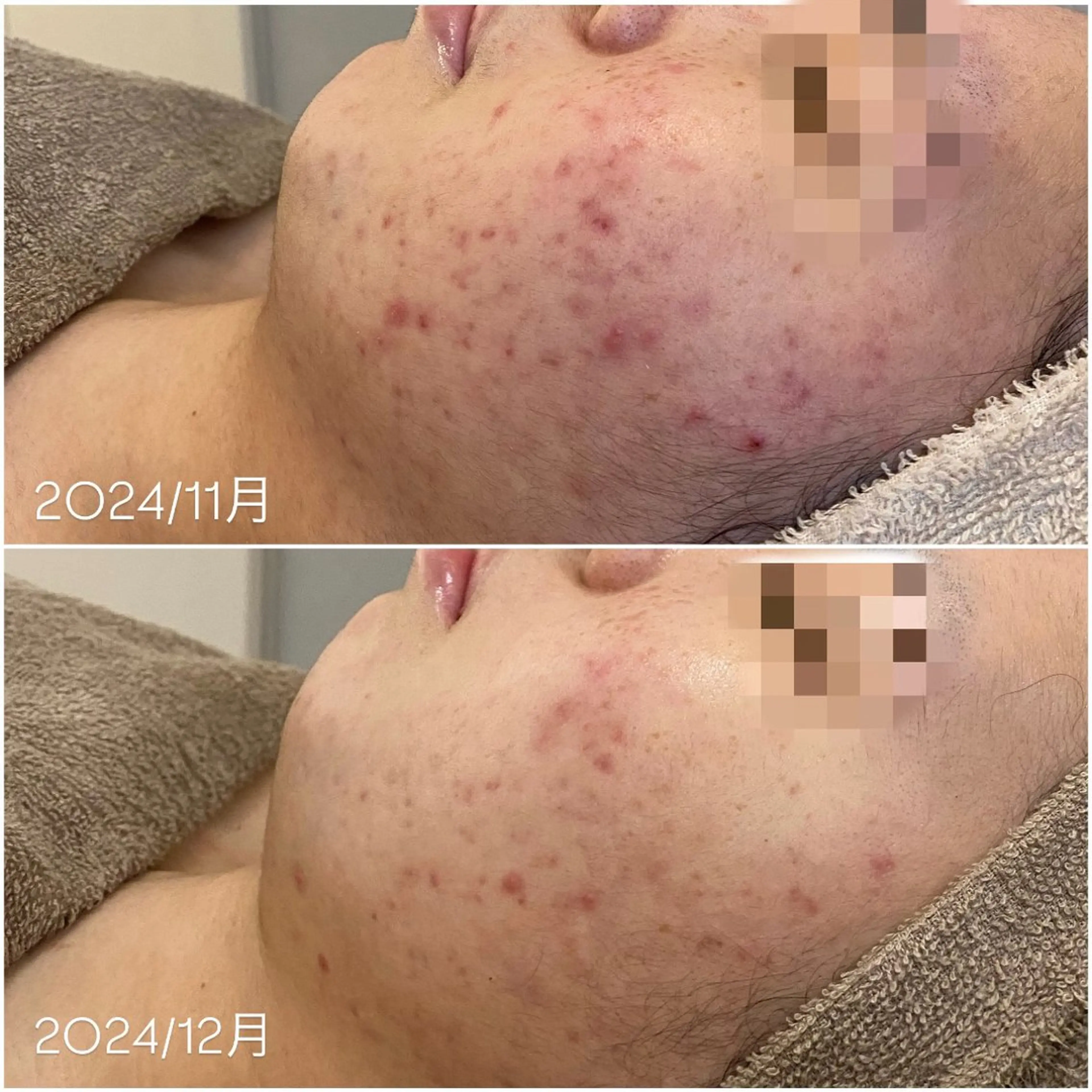 メンズ エステ soph. ソフのエステ・リラクイメージ