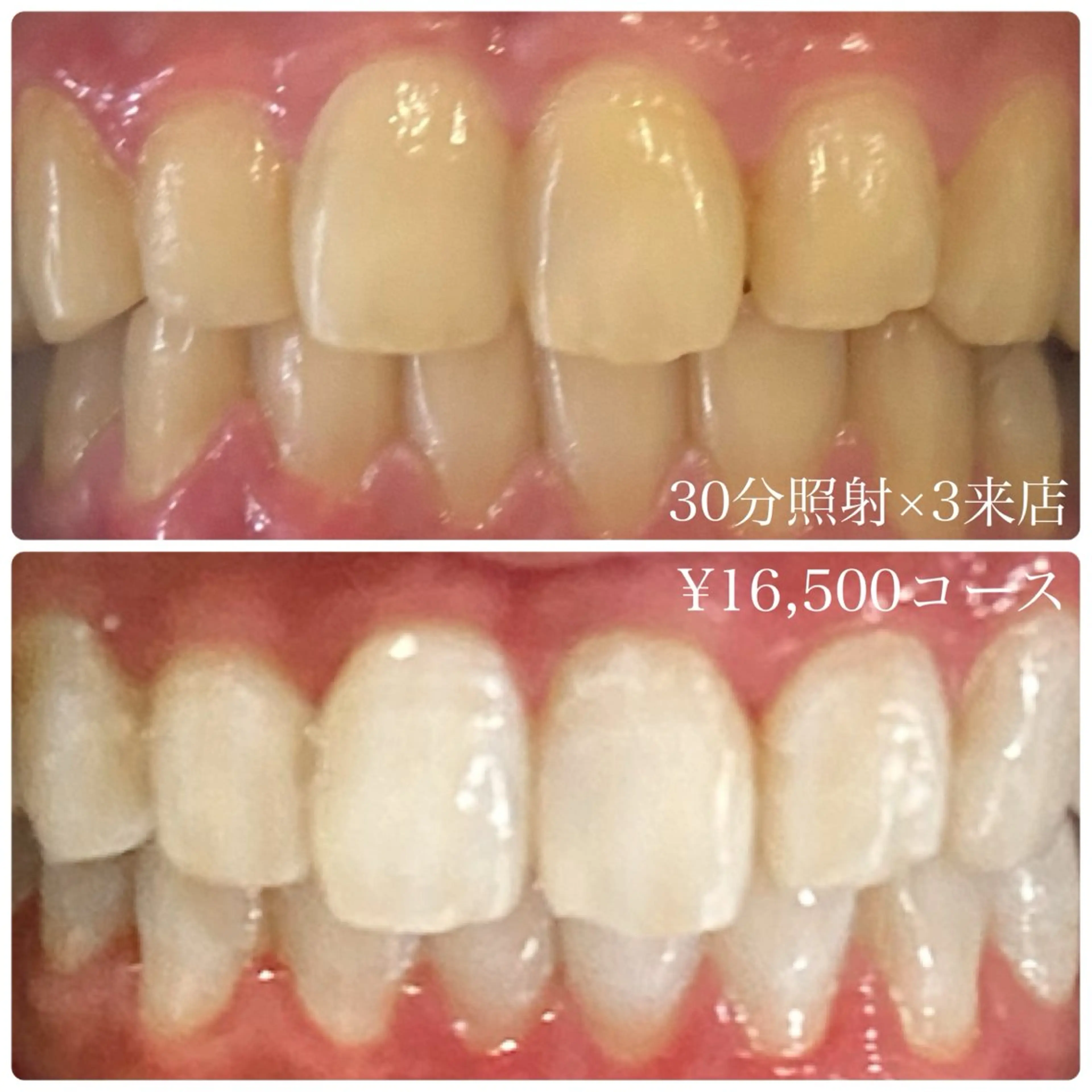 メンズ ホワイトニング ルーム　川崎店のその他イメージ