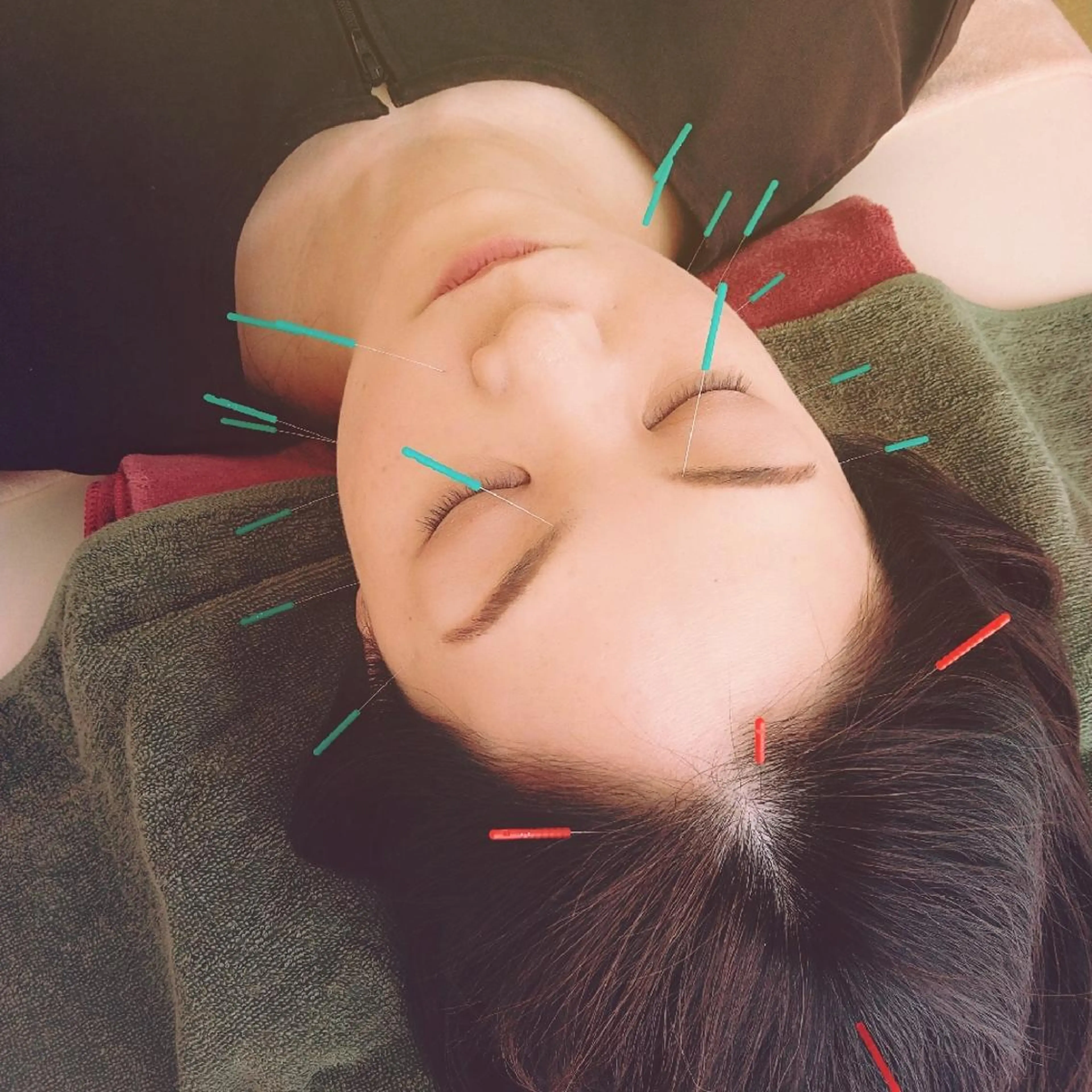 エステ リラク 美身鍼灸はりごこち (大峰)のエステ・リラクイメージ