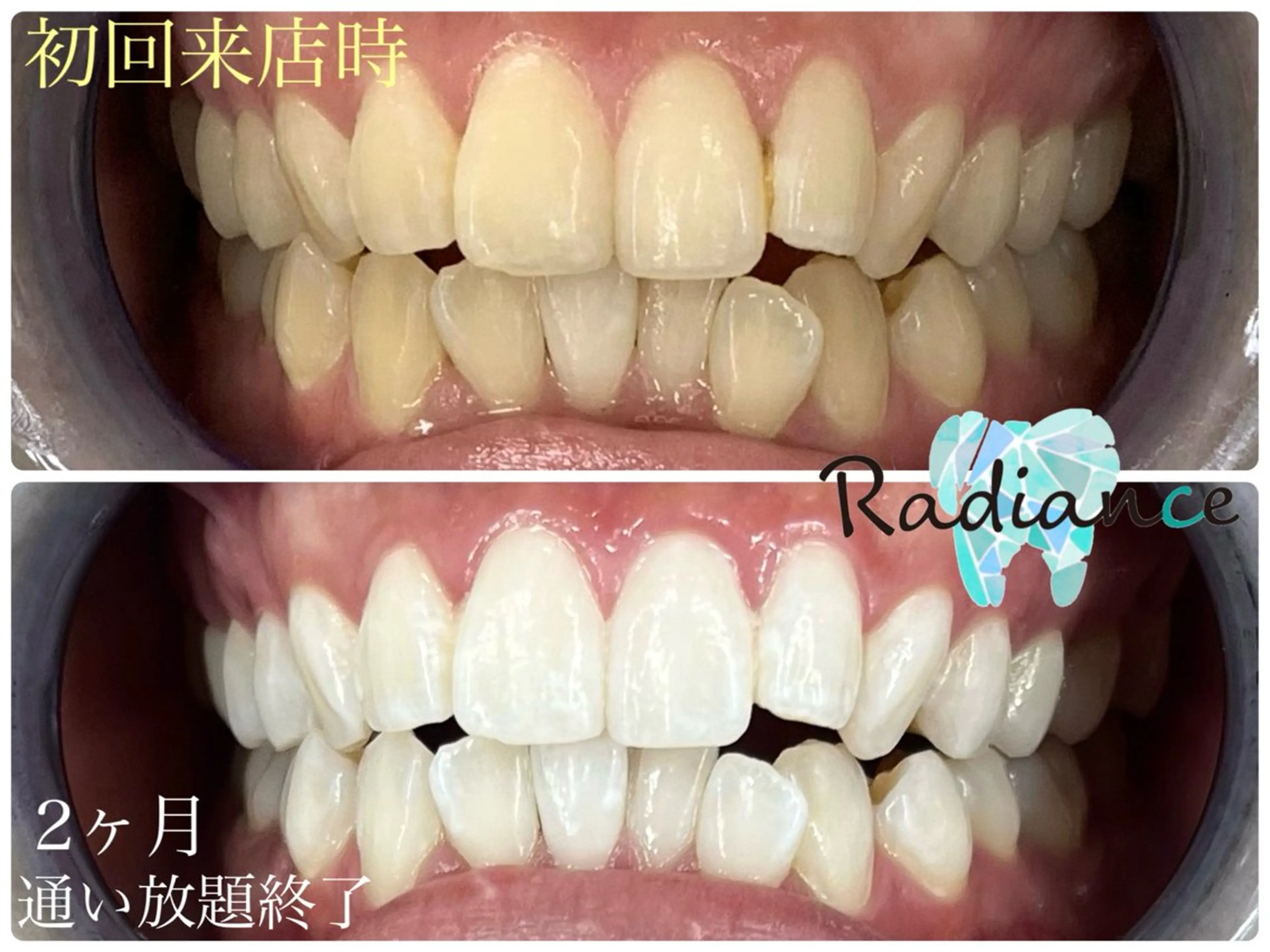 その他 札幌ホワイトニング ラディアンス札幌駅店のその他イメージ