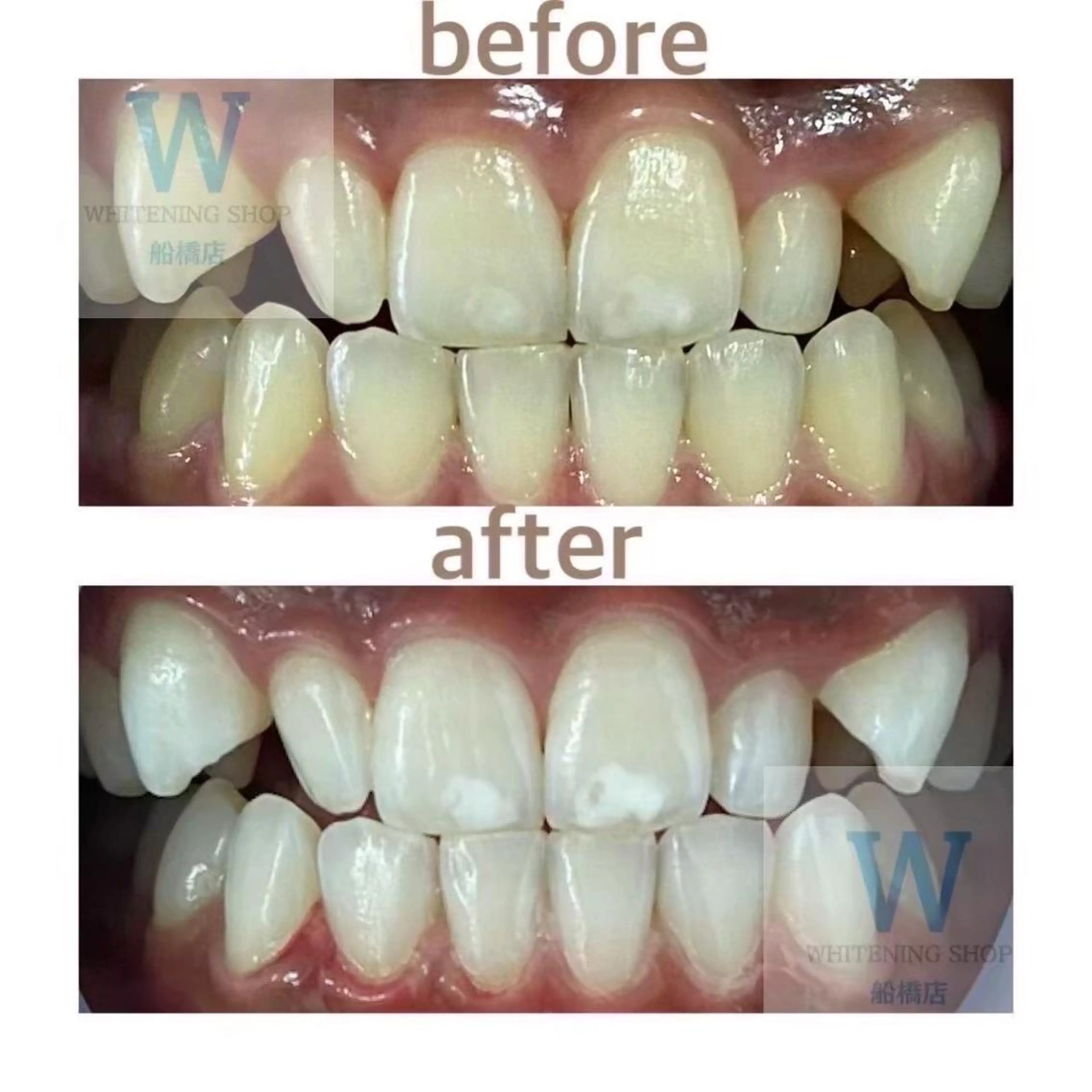 ホワイトニング ショップ船橋２号店のエステ・リラクイメージ