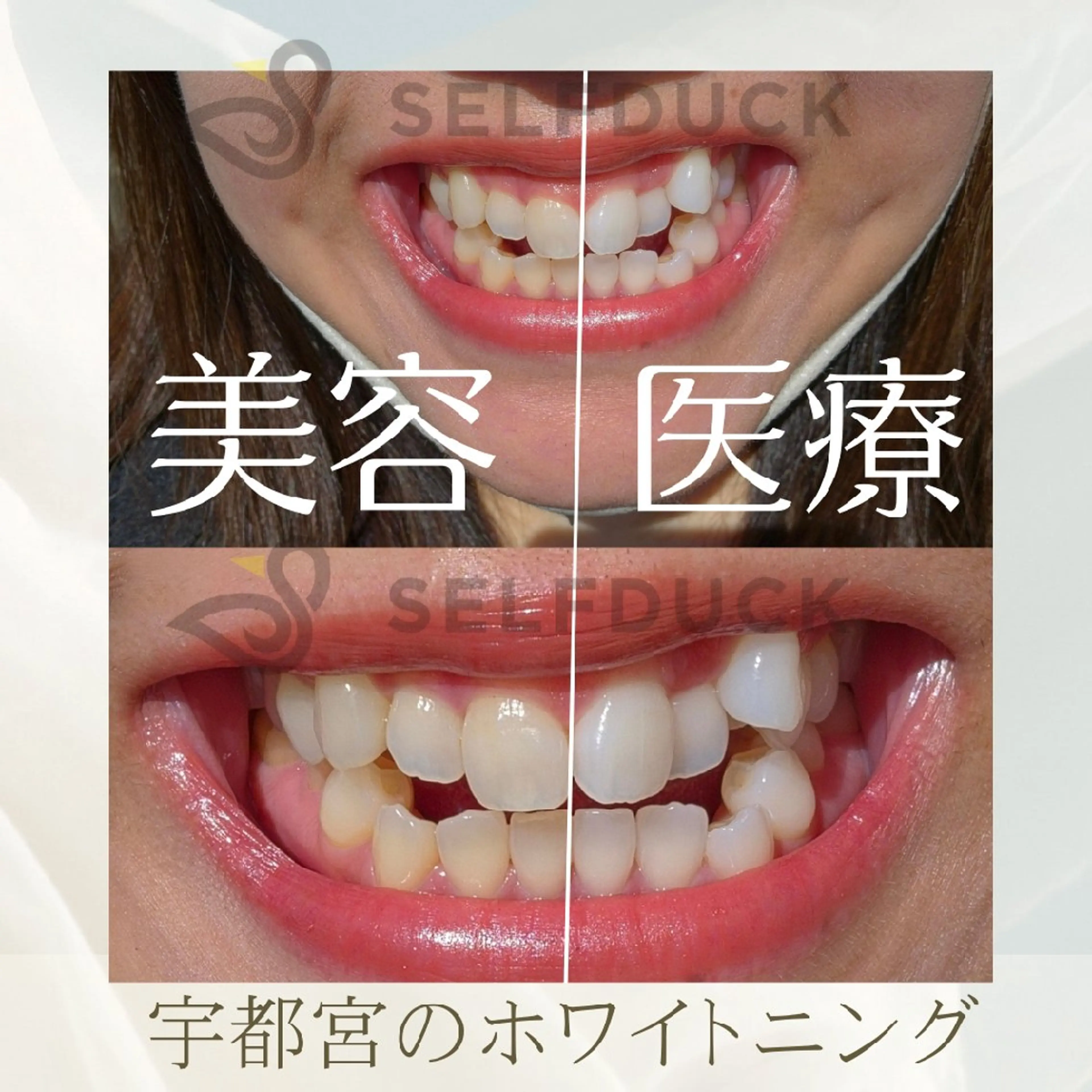 歯科提携セルフダック 宇都宮駒生店のエステ・リラクイメージ