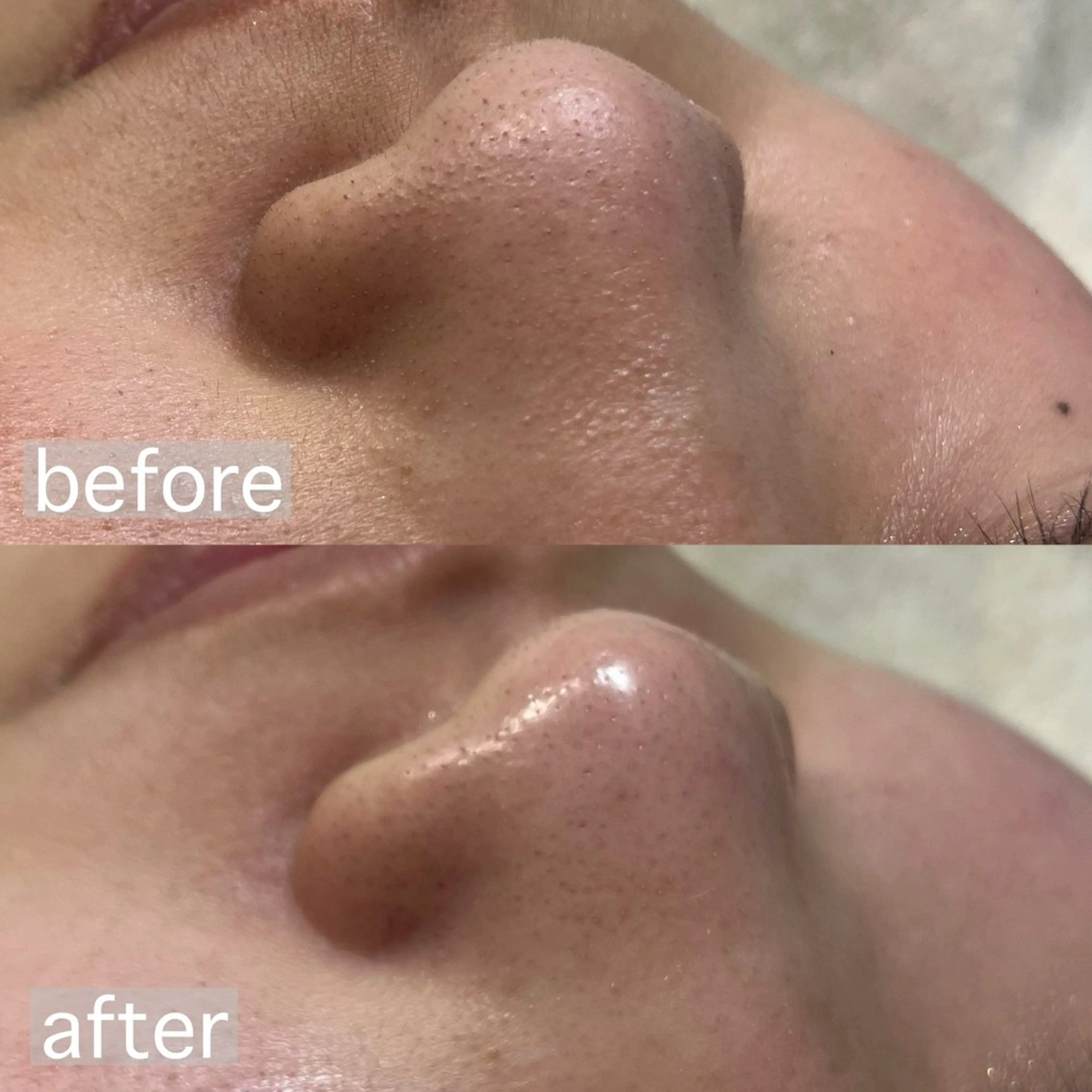 🫧minimo価格🫧フェイシャルワックス＋モデリングパックで鎮静保湿ケア🌿の写真